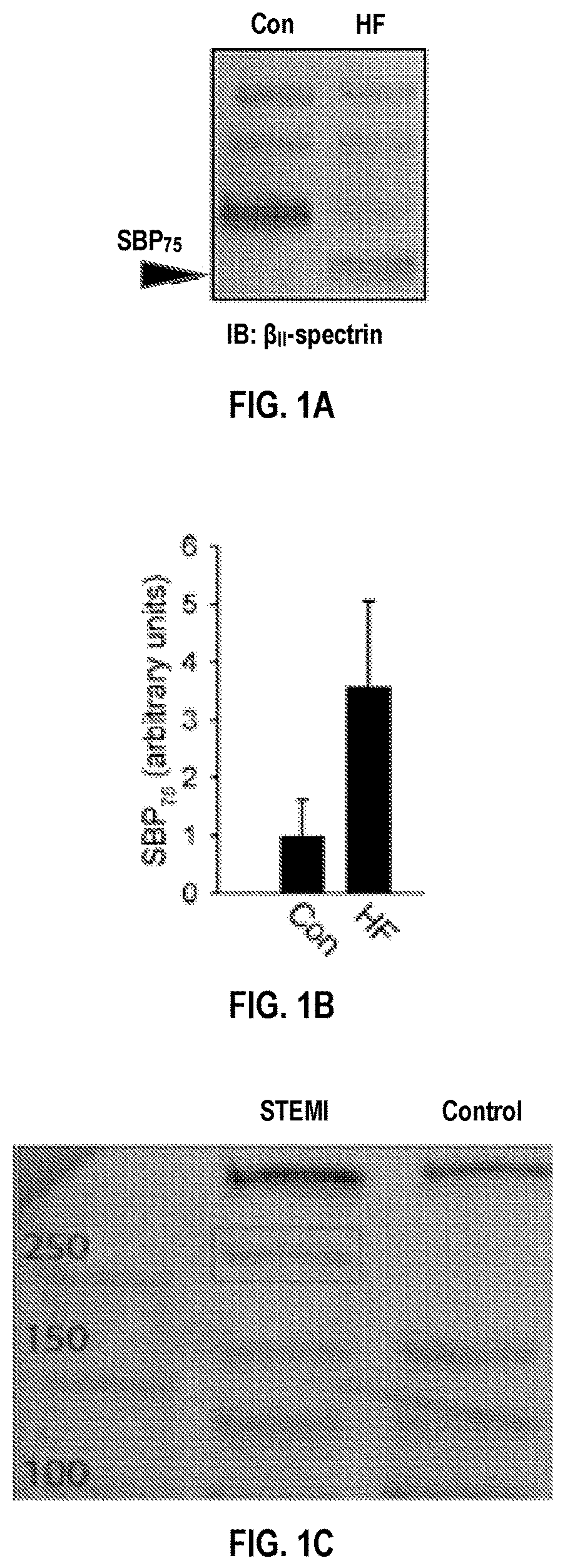 Patent US12590974 Figure 1 – Methods and compositions for cardiovascular disease detection and management