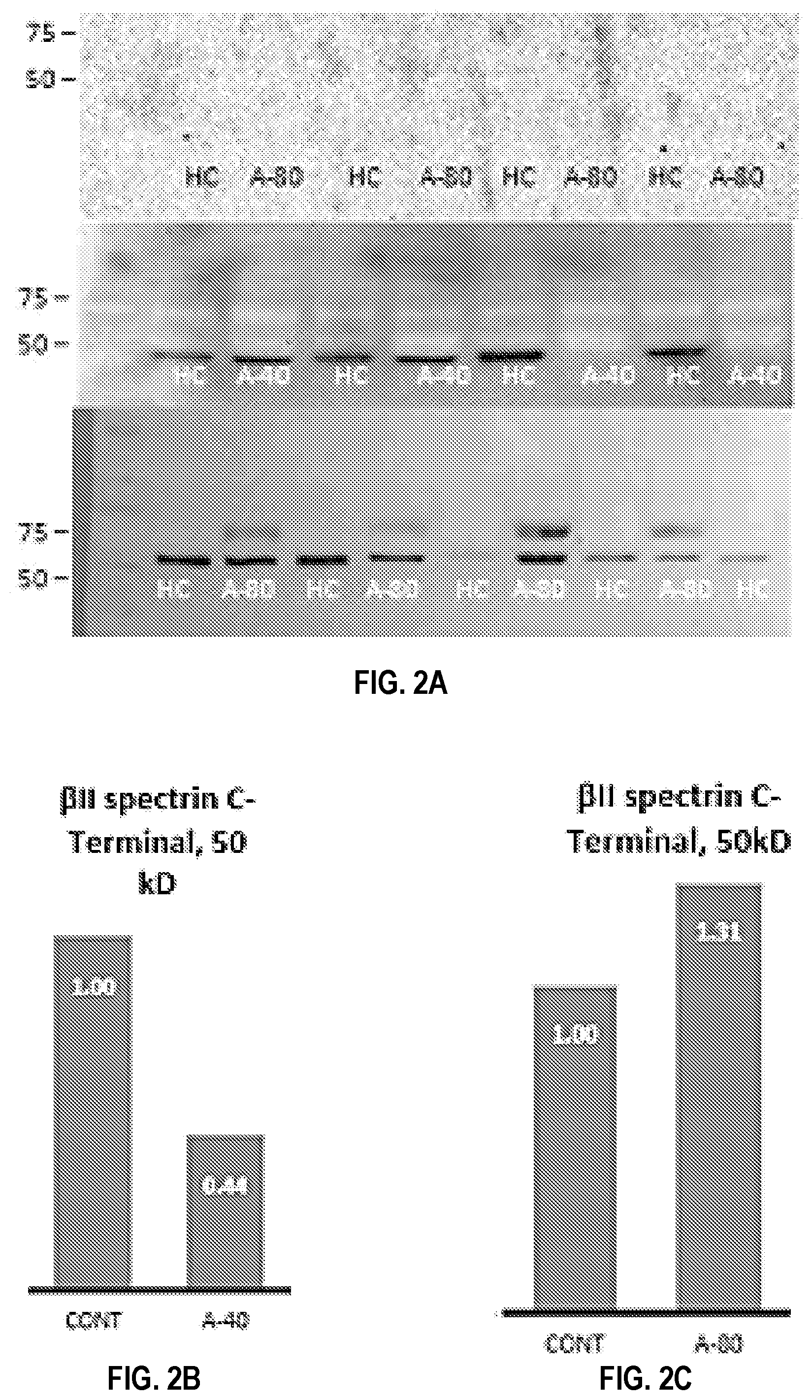 Patent US12590974 Figure 2 – Methods and compositions for cardiovascular disease detection and management