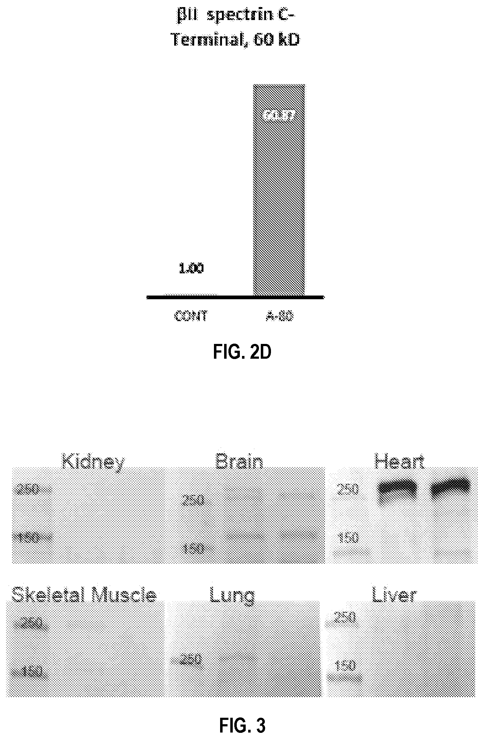 Patent US12590974 Figure 3 – Methods and compositions for cardiovascular disease detection and management