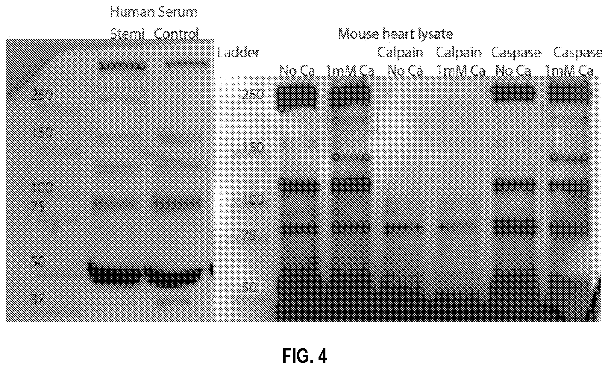 Patent US12590974 Figure 4 – Methods and compositions for cardiovascular disease detection and management