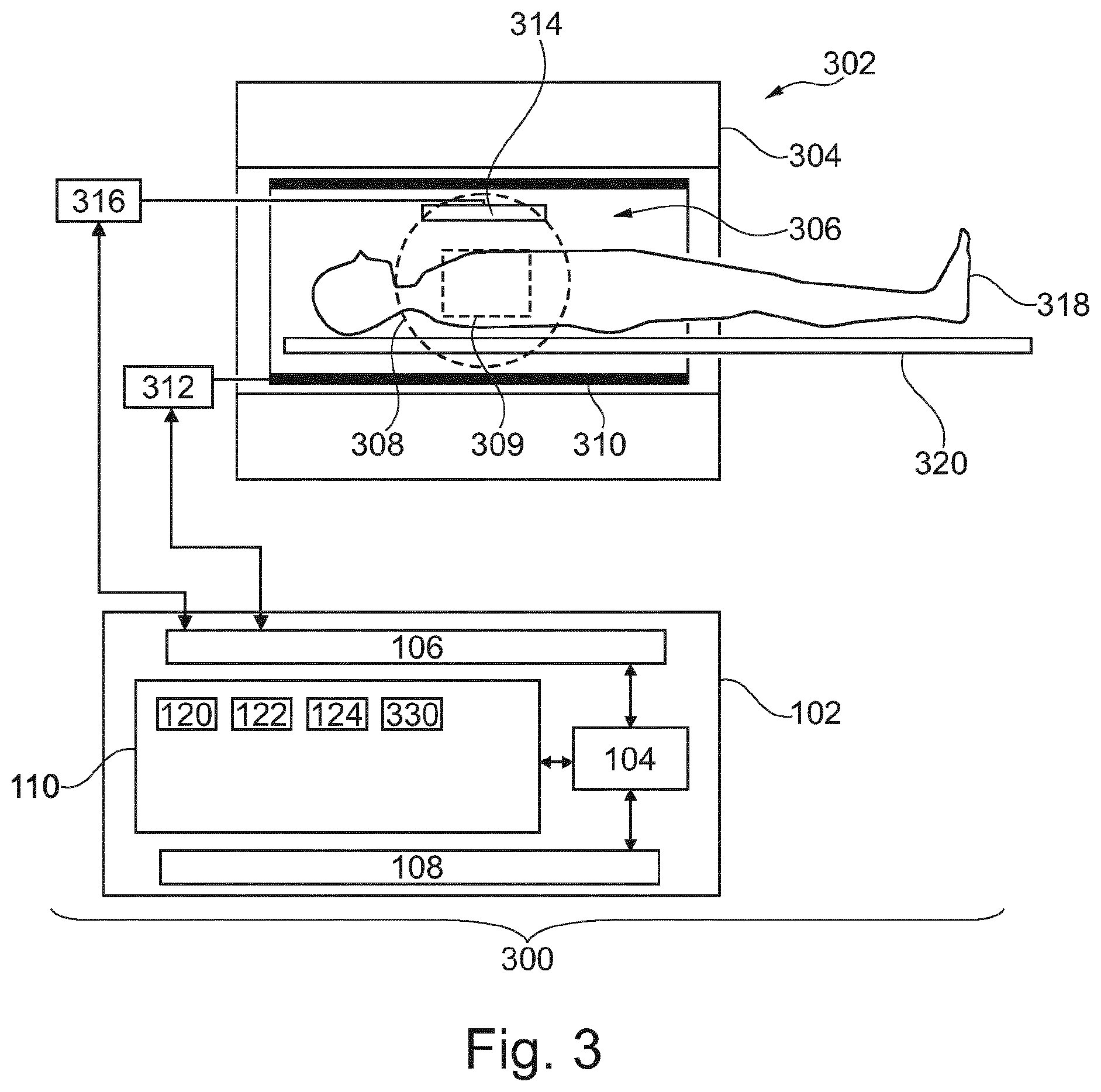 Patent US12591030 Figure 3 – K-space sampling for accelerated stack-of-stars magnetic resonance imaging using compressed sense and AI