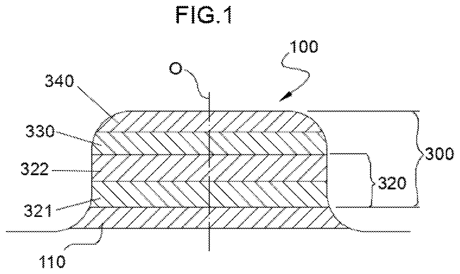 Patent US12591134 Figure 1 – Lens assembly, camera module having a lens assembly for motor vehicles, and a method for making lens assembly