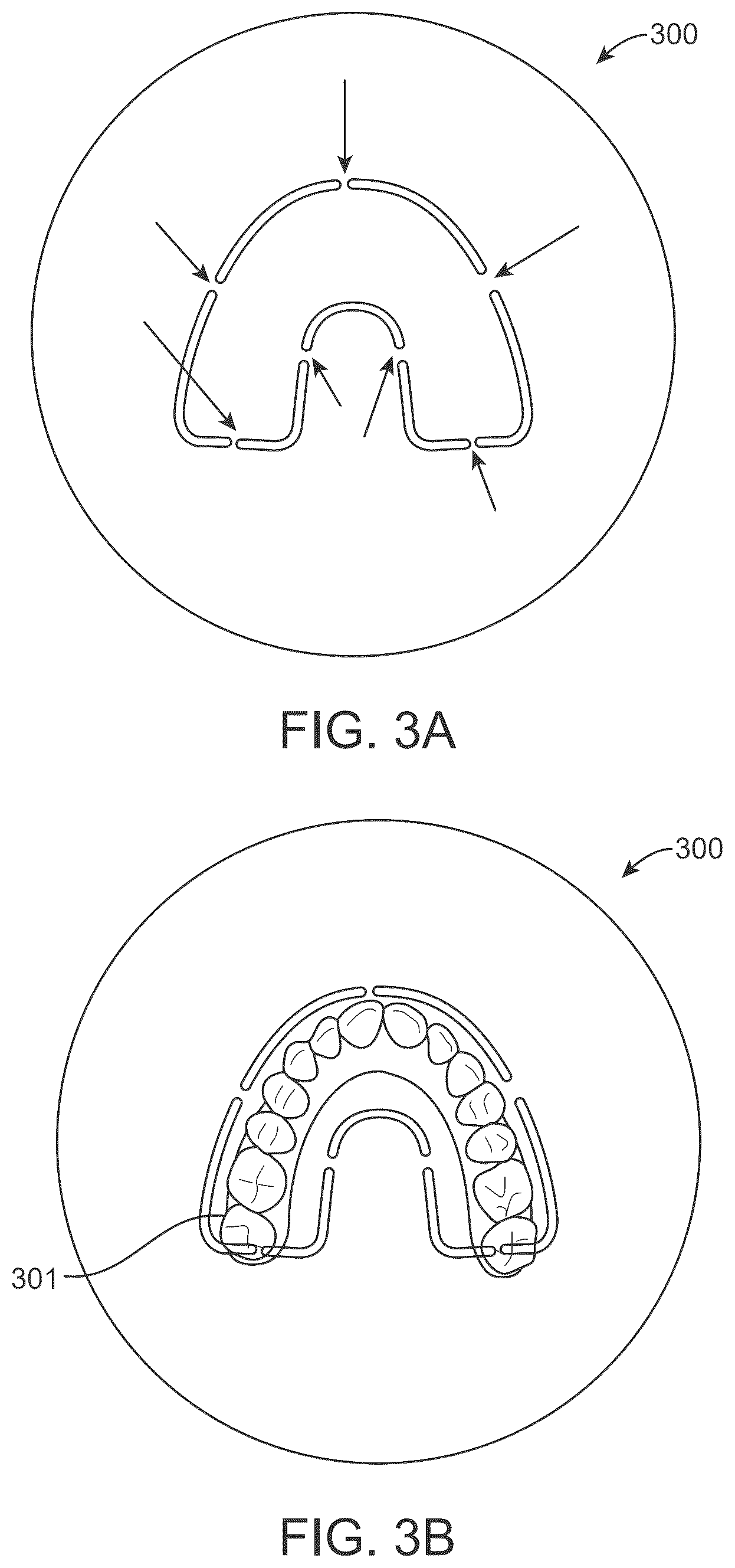 Patent US12591215 Figure 3 – System and method for forming dental appliances