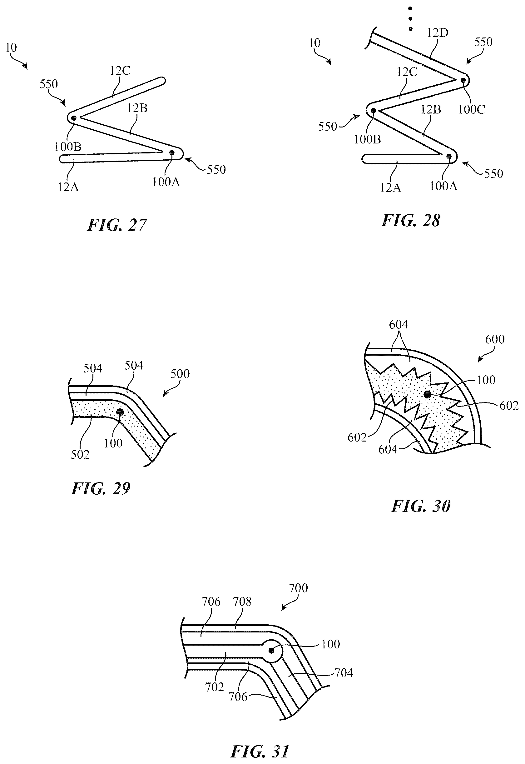 Patent US12591330 Figure 17 – Electronic devices with display and touch sensor structures