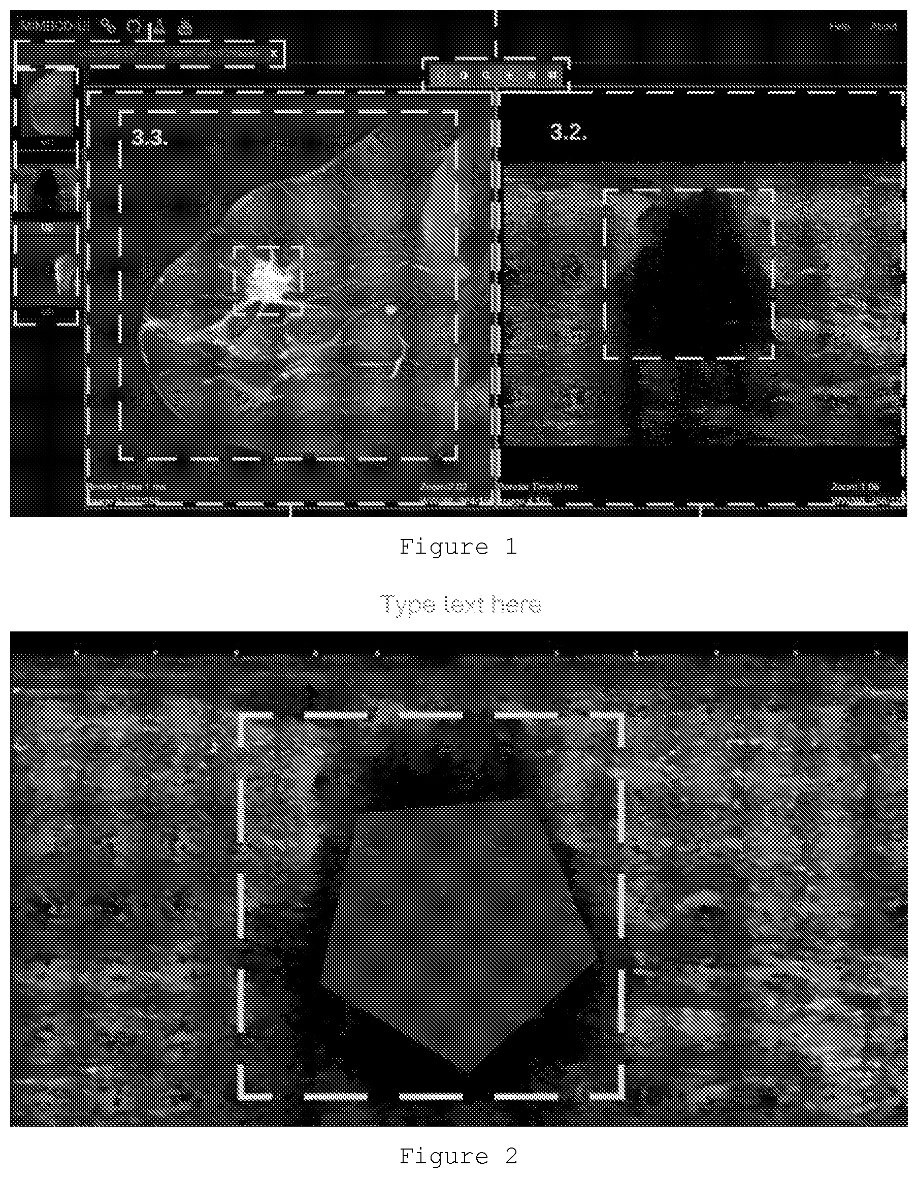 Patent US12591964 Figure 1 – Correlating geometric shapes of segmented regions by at least two different imaging technologies for improved identification of breast lesions