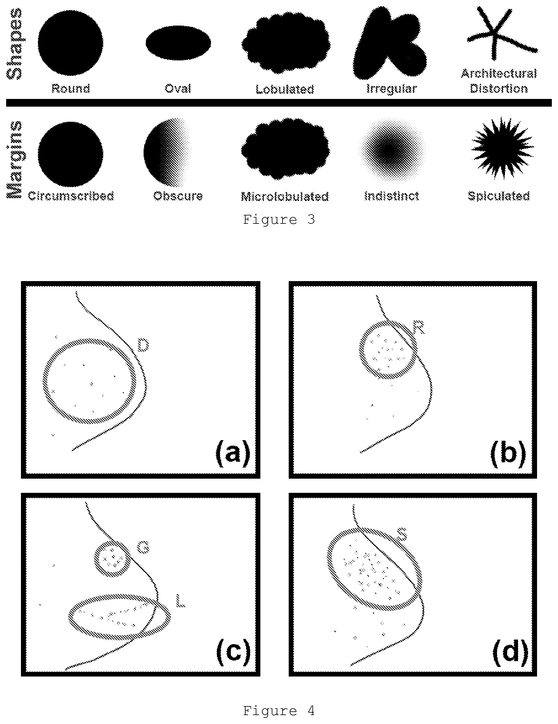 Patent US12591964 Figure 2 – Correlating geometric shapes of segmented regions by at least two different imaging technologies for improved identification of breast lesions