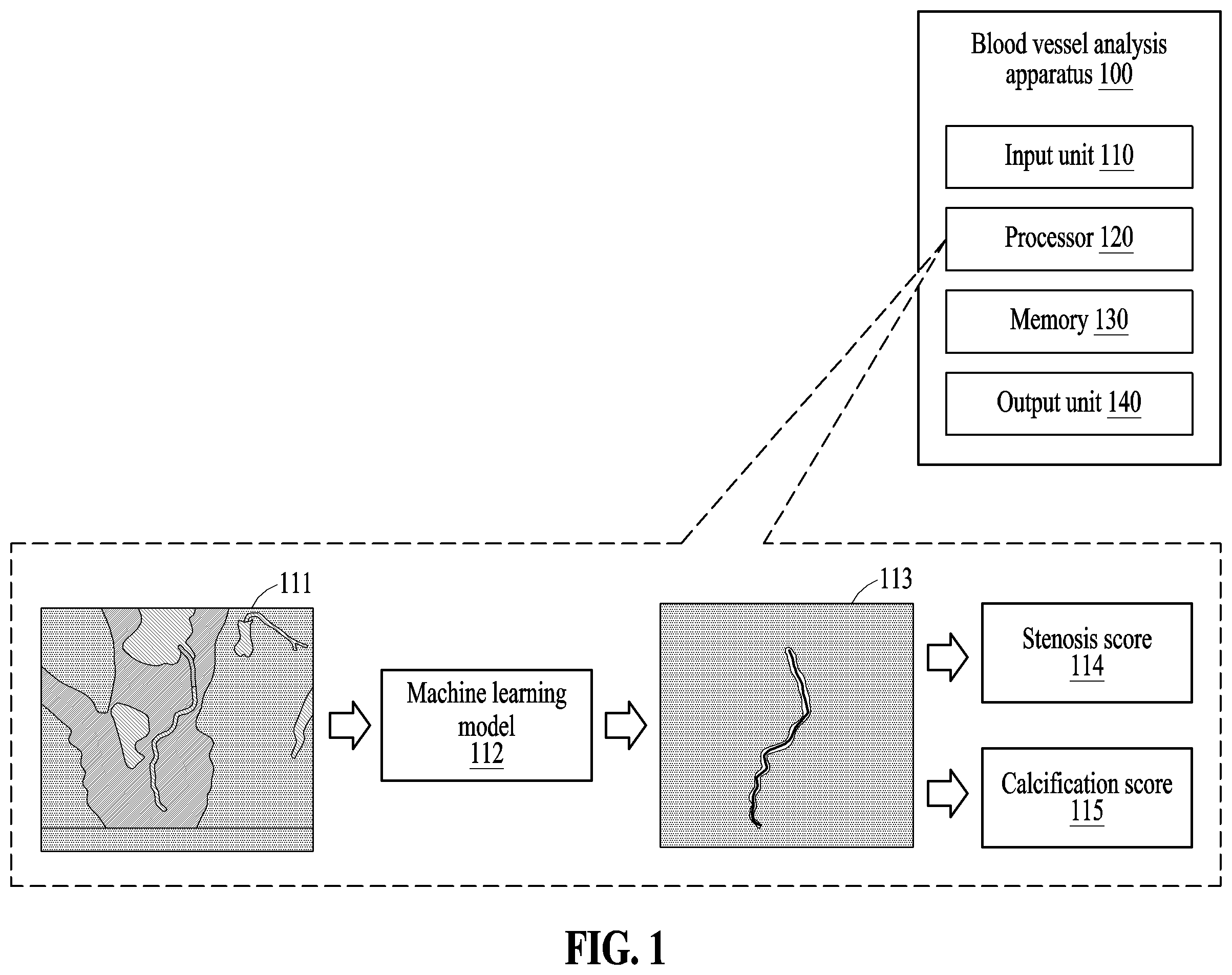 Patent US12591966 Figure 1 – Method and apparatus for analyzing blood vessel based on machine learning model