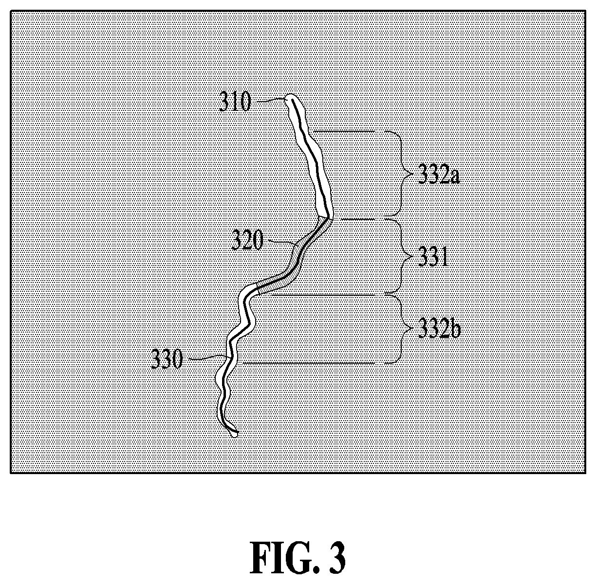 Patent US12591966 Figure 3 – Method and apparatus for analyzing blood vessel based on machine learning model