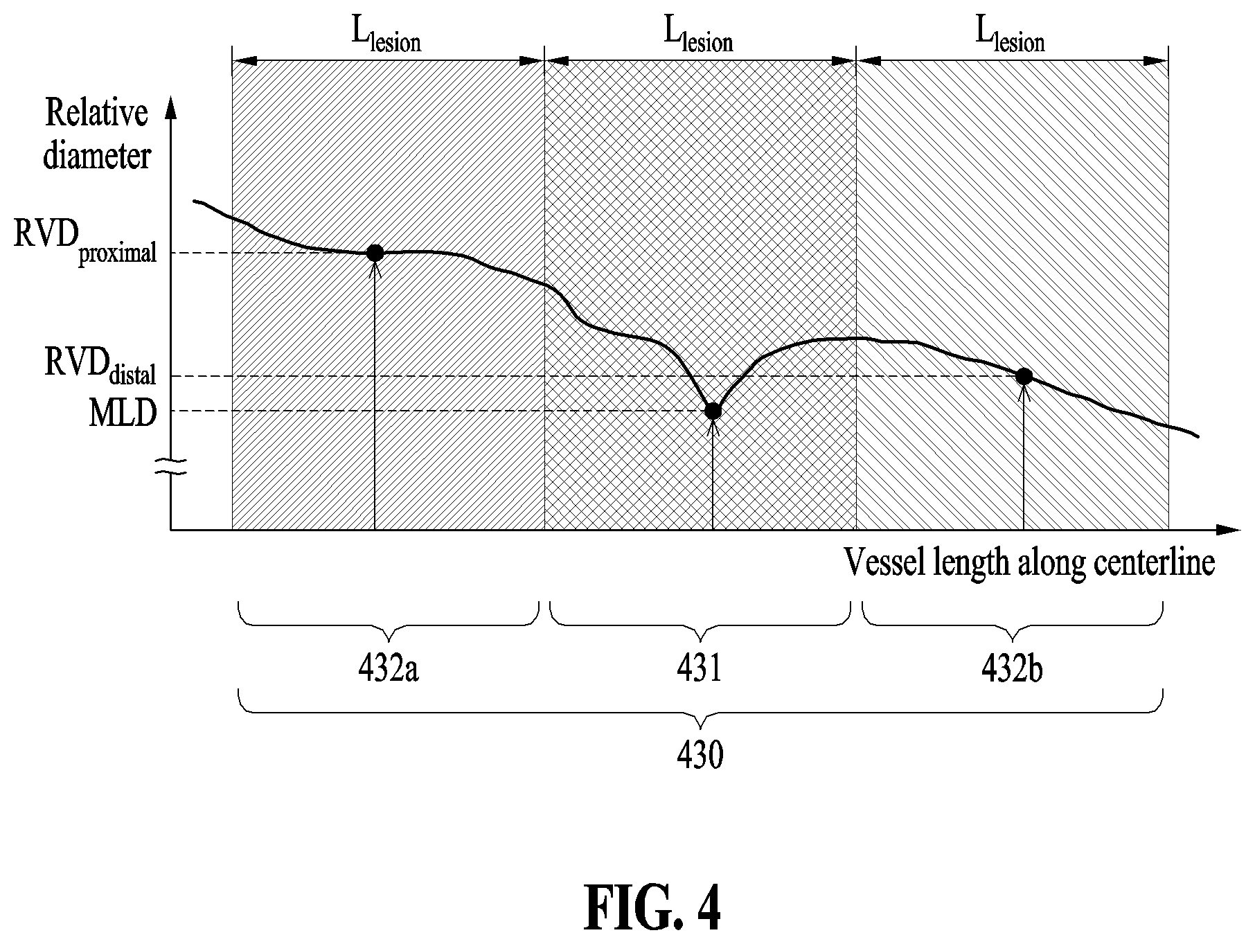 Patent US12591966 Figure 4 – Method and apparatus for analyzing blood vessel based on machine learning model