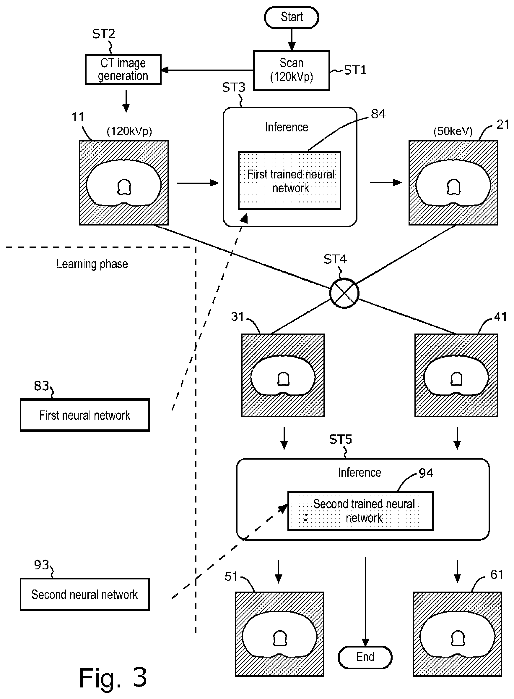 Patent US12591972 Figure 3 – Device for inferring material density image, CT system, storage medium, and method of creating trained neural network