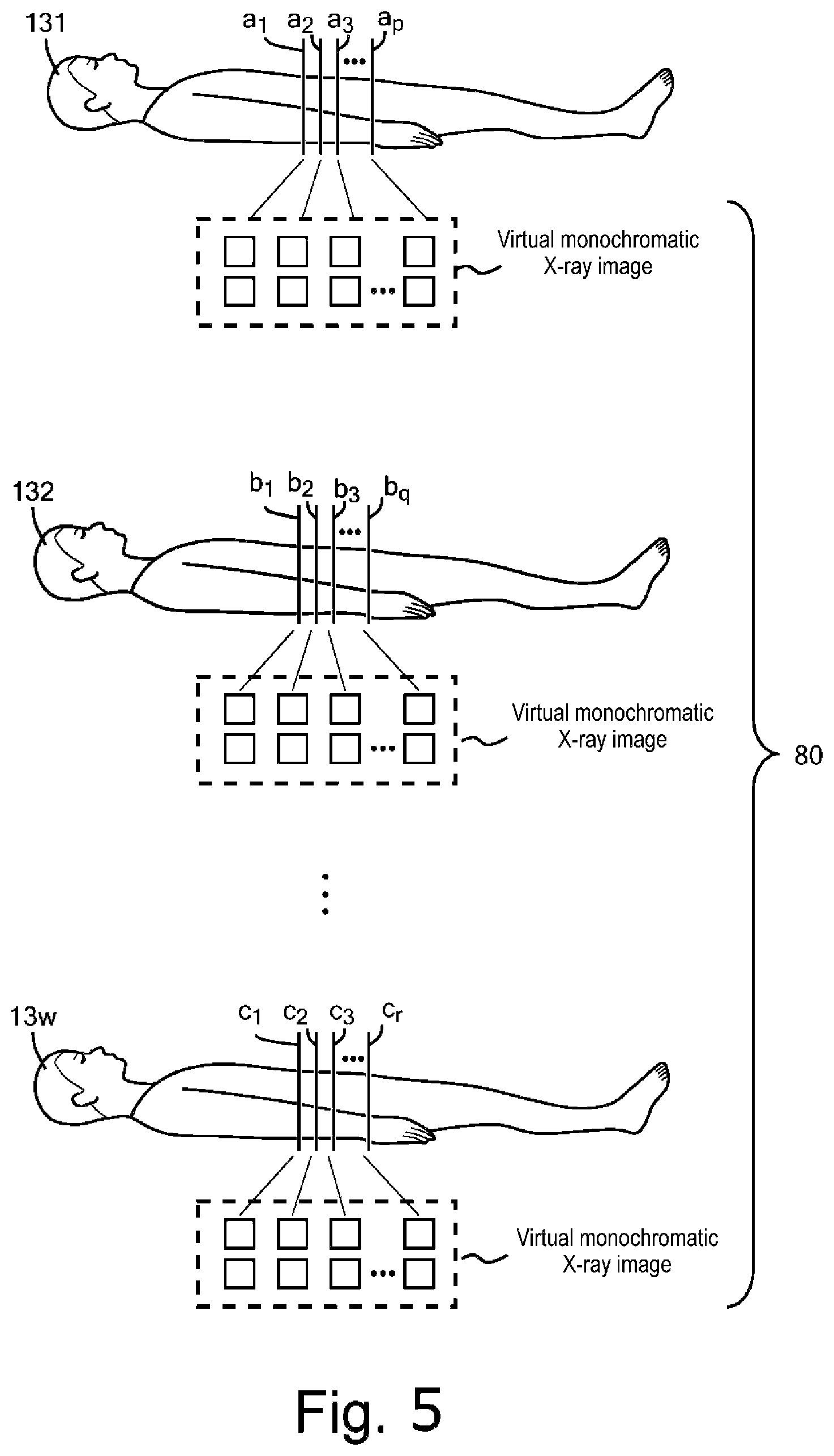 Patent US12591972 Figure 5 – Device for inferring material density image, CT system, storage medium, and method of creating trained neural network