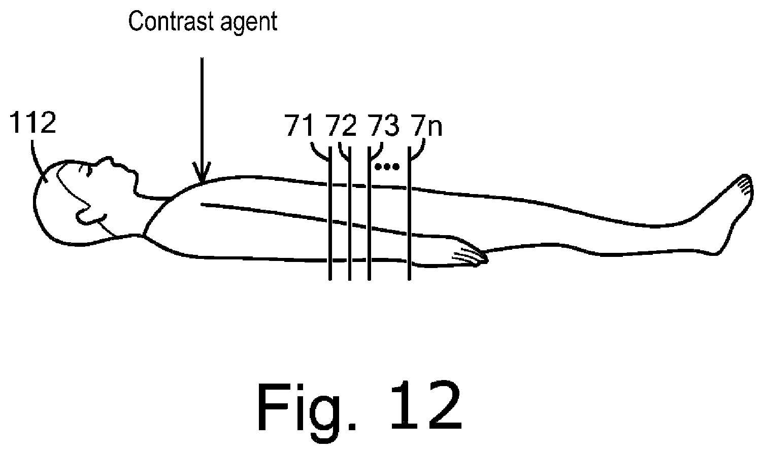 Patent US12591972 Figure 12 – Device for inferring material density image, CT system, storage medium, and method of creating trained neural network