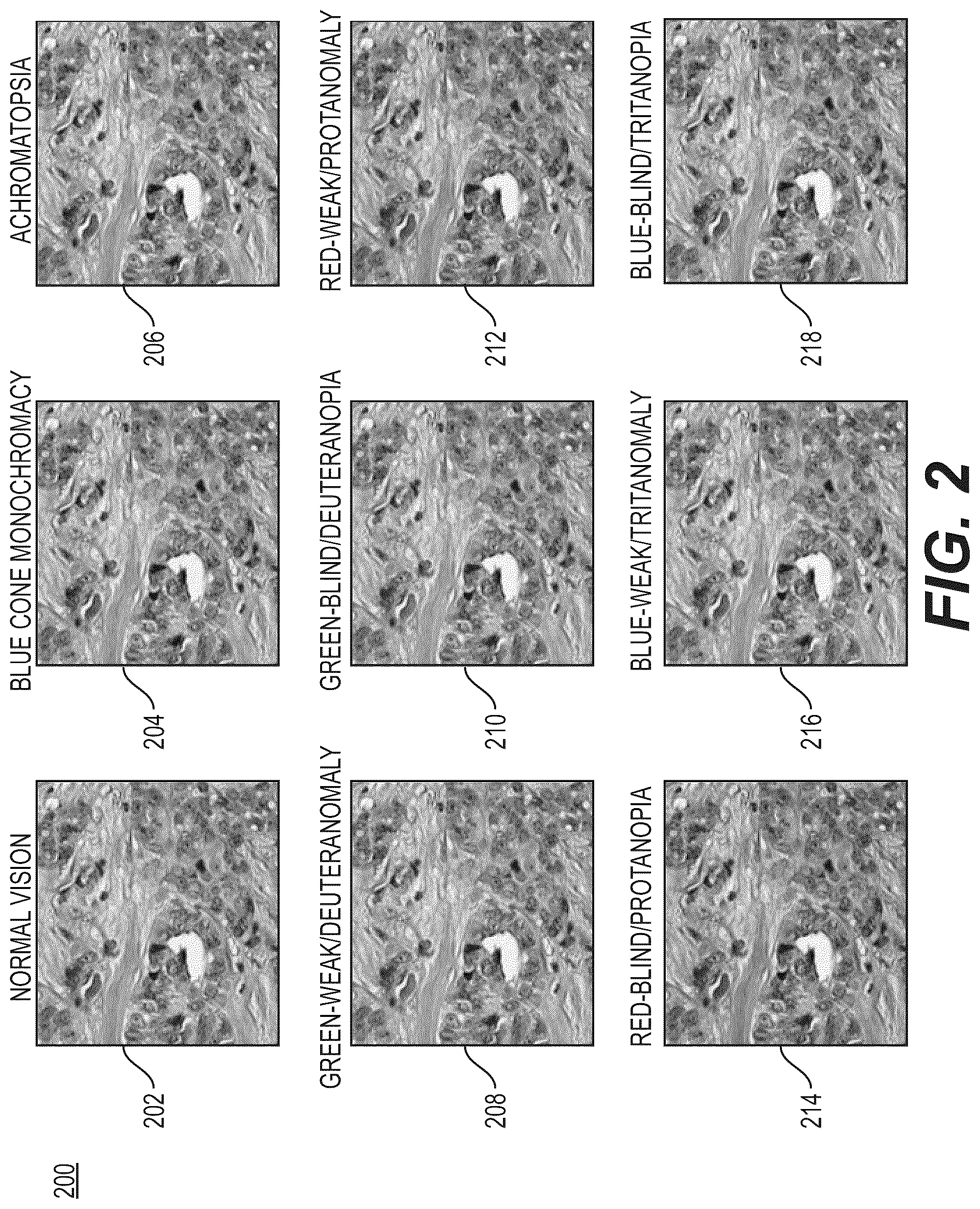 Patent US12592000 Figure 4 – Systems and methods for processing digital images to adapt to color vision deficiency