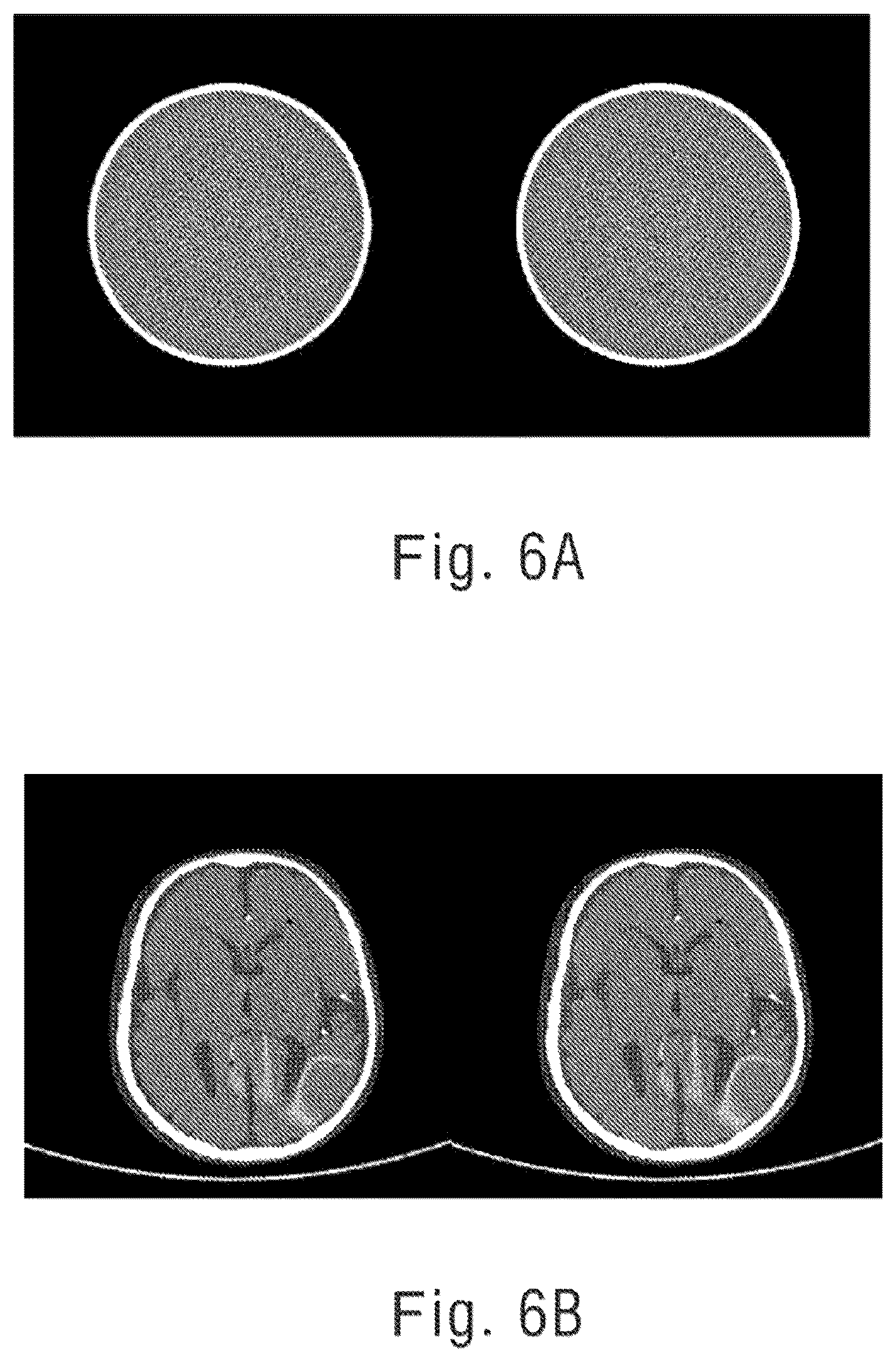 Patent US12592015 Figure 6 – Predicting scattered signal of x-ray, and correcting scattered beam