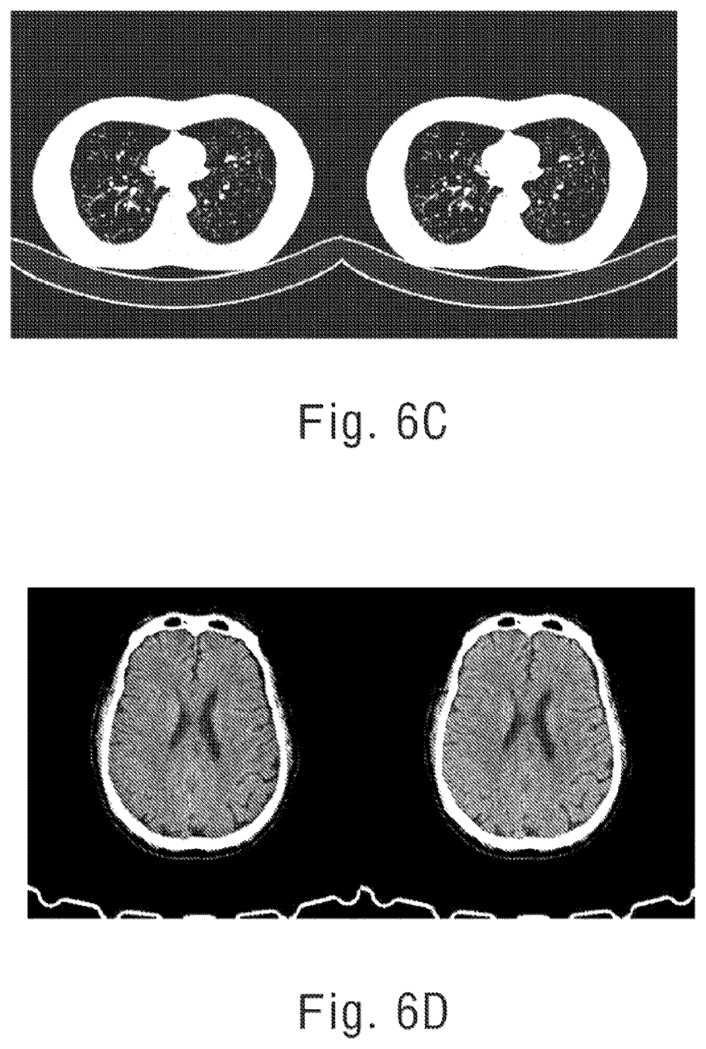 Patent US12592015 Figure 7 – Predicting scattered signal of x-ray, and correcting scattered beam