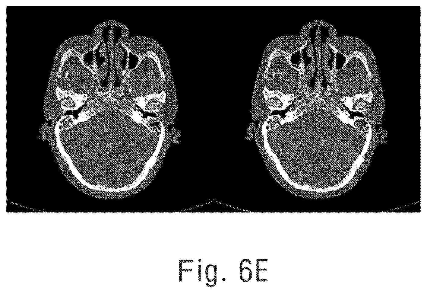 Patent US12592015 Figure 8 – Predicting scattered signal of x-ray, and correcting scattered beam