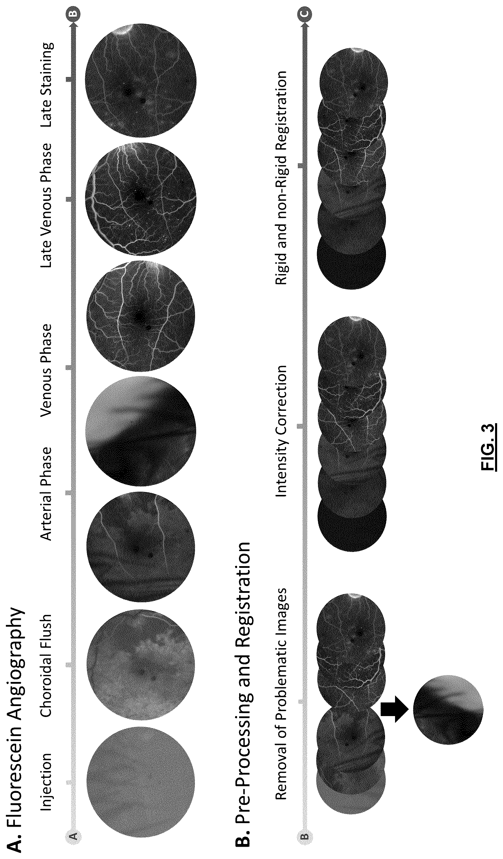 Patent US12592057 Figure 3 – System and method for detecting and classifying retinal microaneurysms