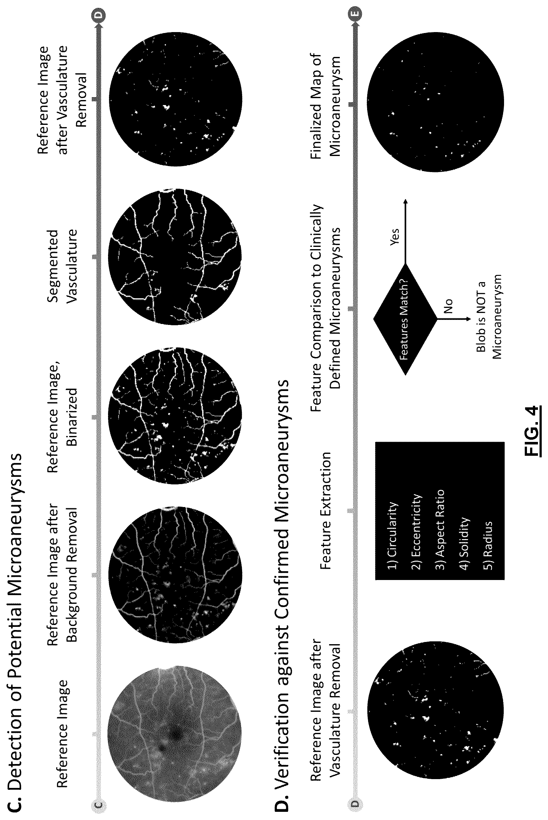 Patent US12592057 Figure 4 – System and method for detecting and classifying retinal microaneurysms
