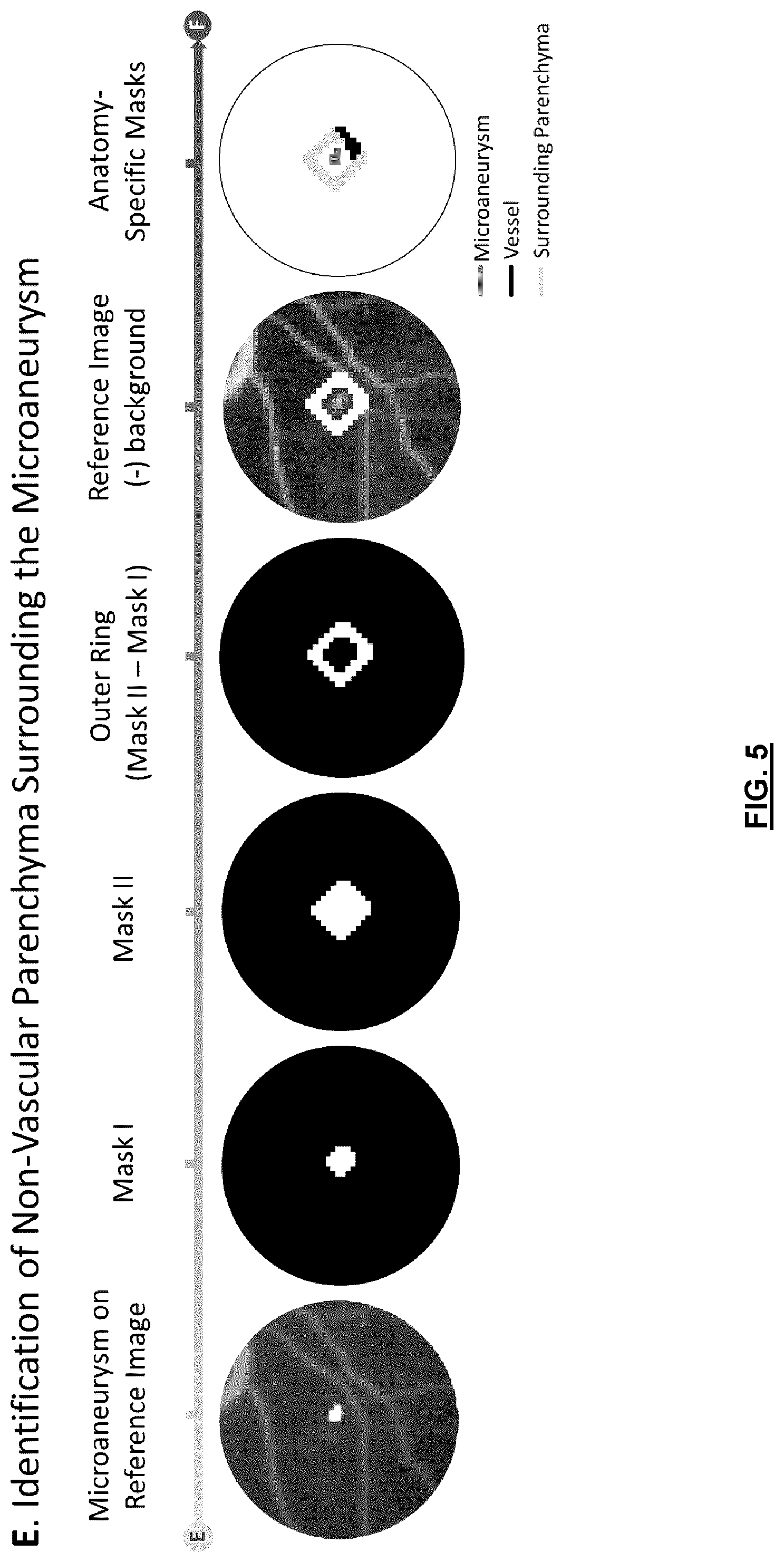 Patent US12592057 Figure 5 – System and method for detecting and classifying retinal microaneurysms