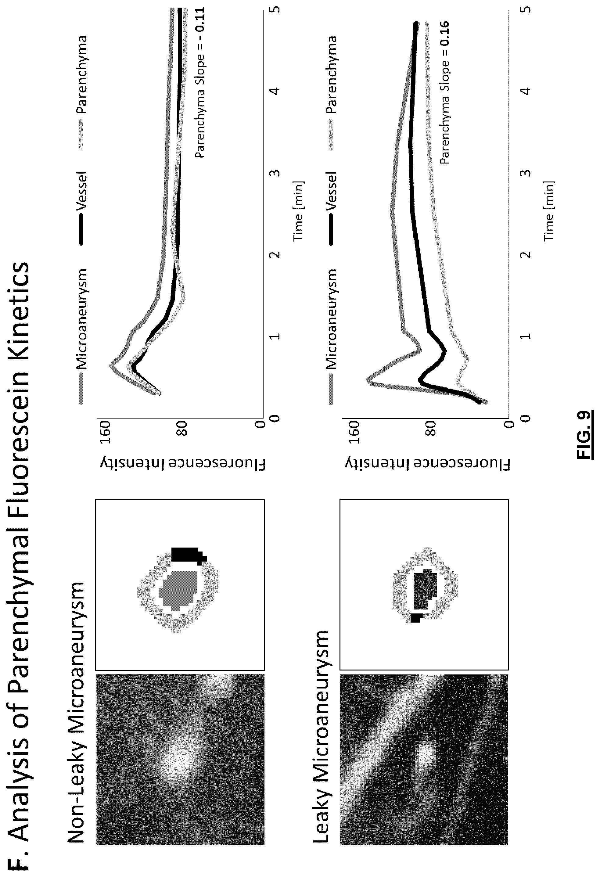 Patent US12592057 Figure 9 – System and method for detecting and classifying retinal microaneurysms