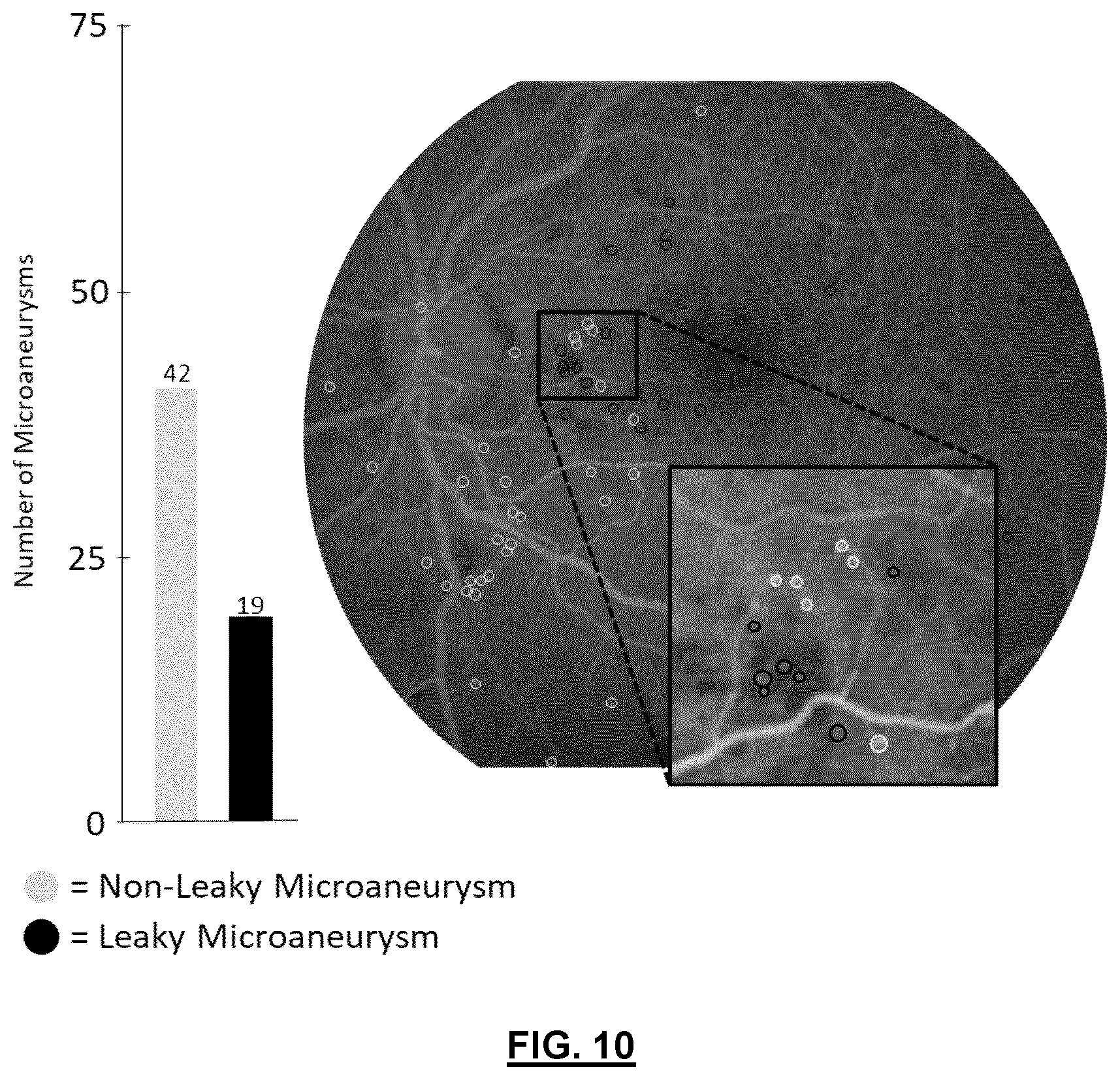 Patent US12592057 Figure 10 – System and method for detecting and classifying retinal microaneurysms