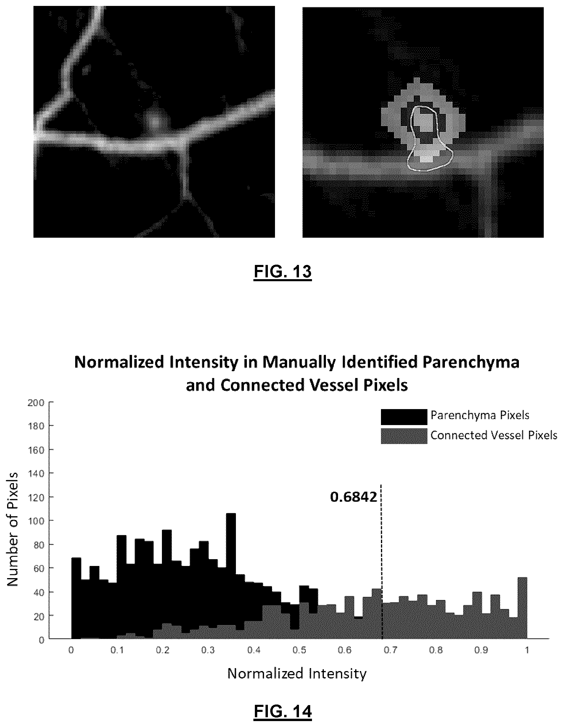 Patent US12592057 Figure 15 – System and method for detecting and classifying retinal microaneurysms