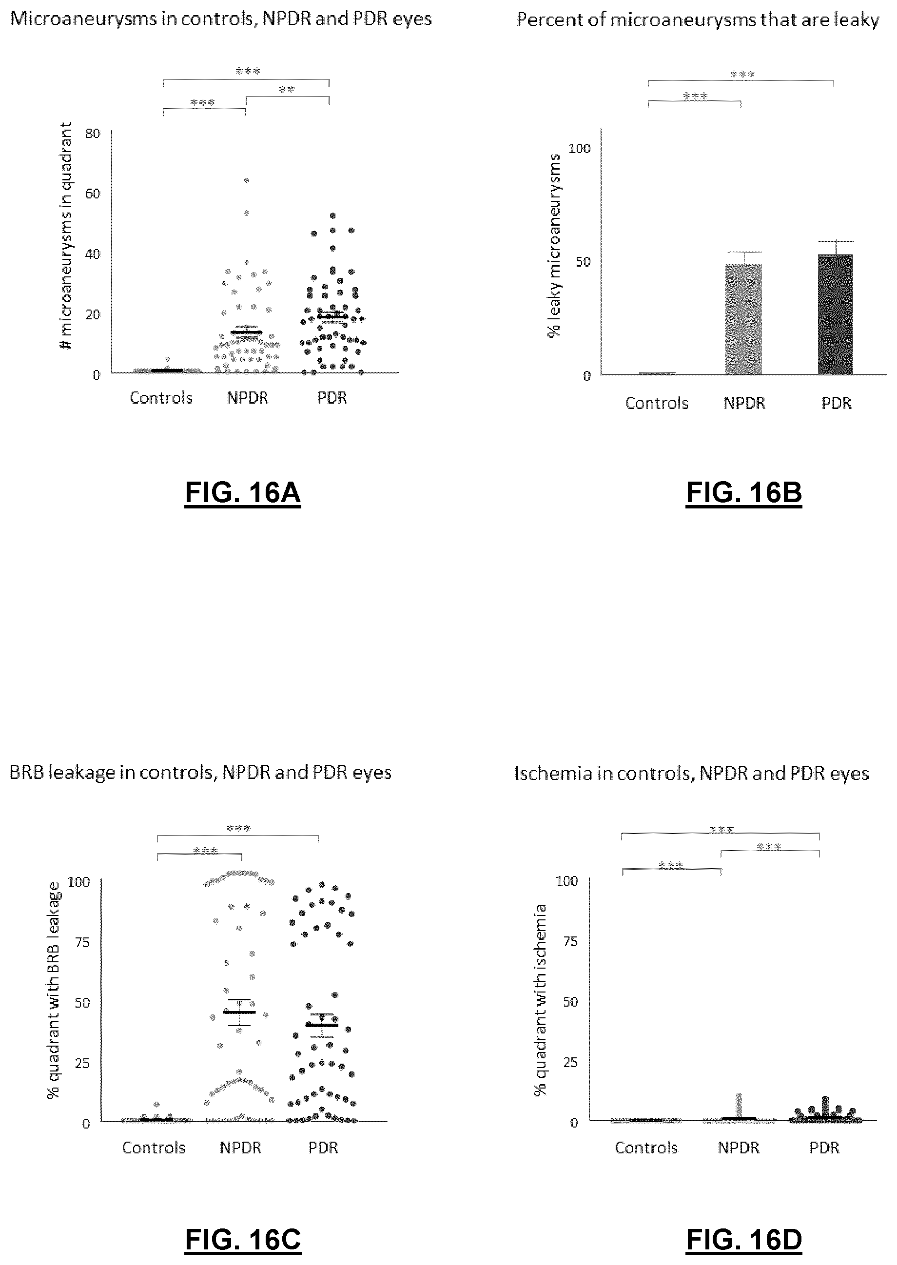 Patent US12592057 Figure 17 – System and method for detecting and classifying retinal microaneurysms