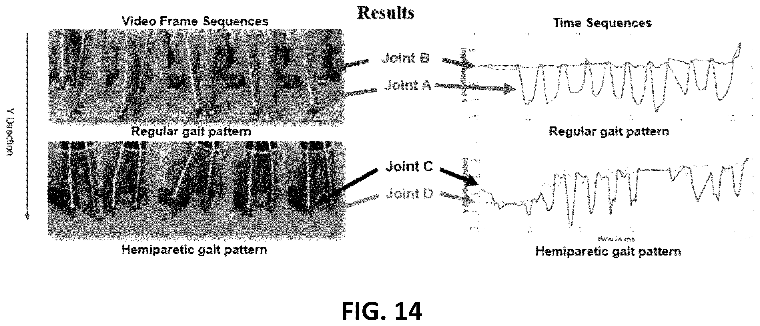 Patent US12592097 Figure 14 – Real-time, fine-resolution human intra-gait pattern recognition based on deep learning models
