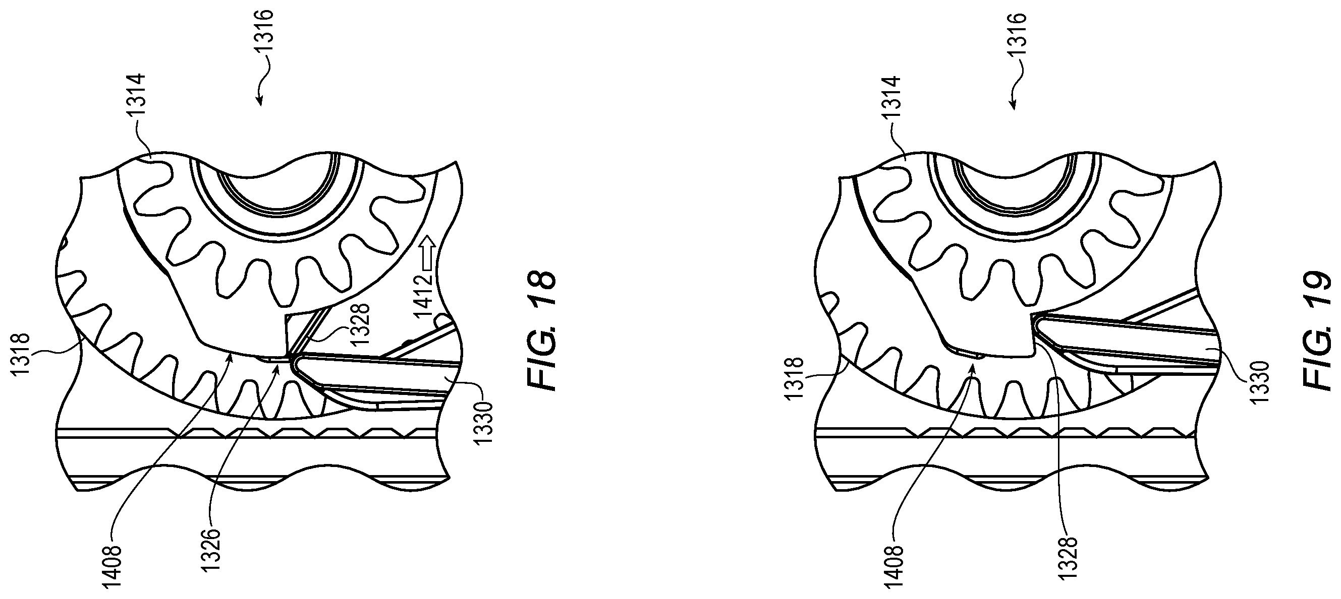 Patent US12592113 Figure 17 – Dual cassette