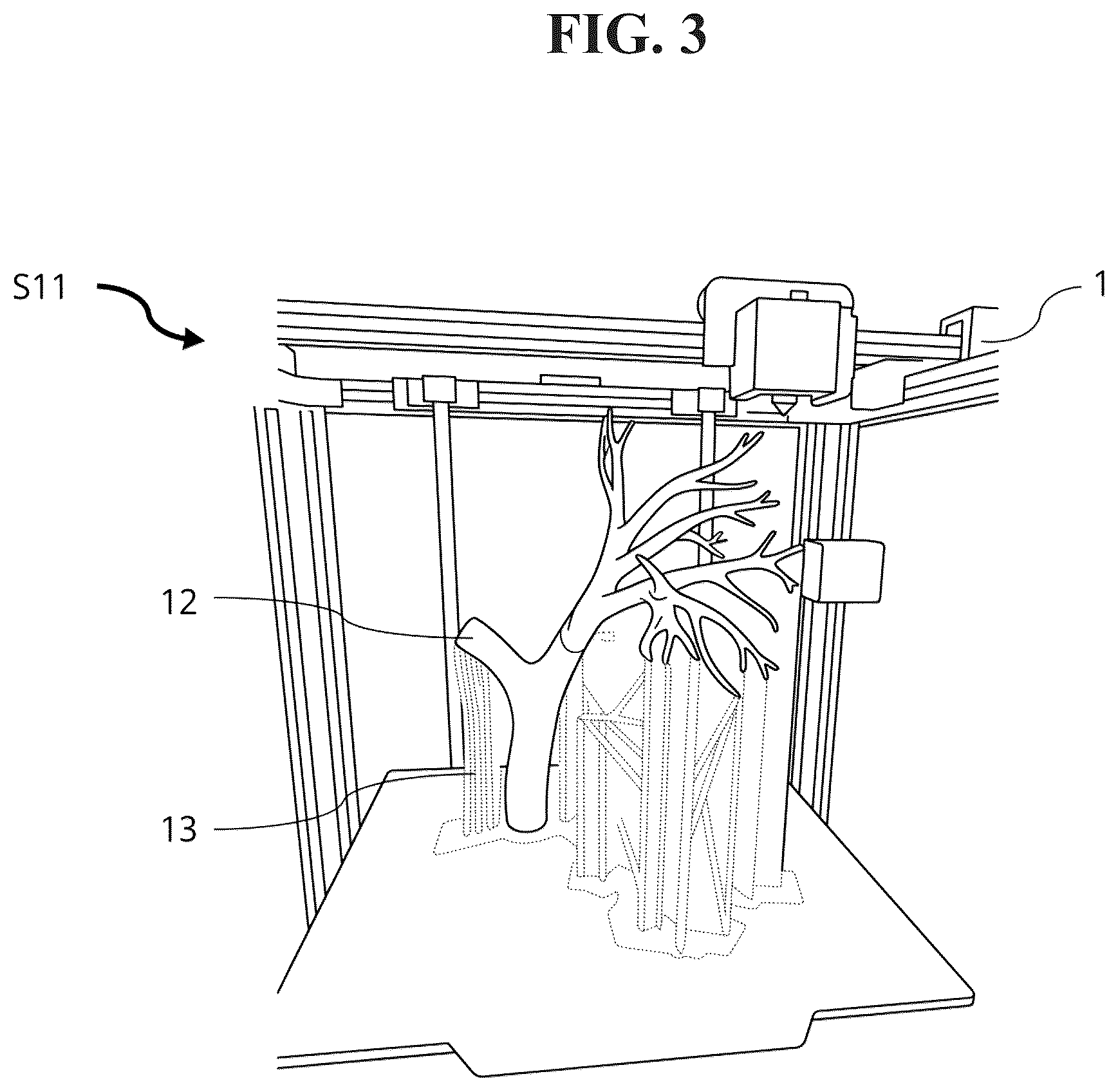 Patent US12592165 Figure 3 – Manufacturing method of bronchoscopy simulator