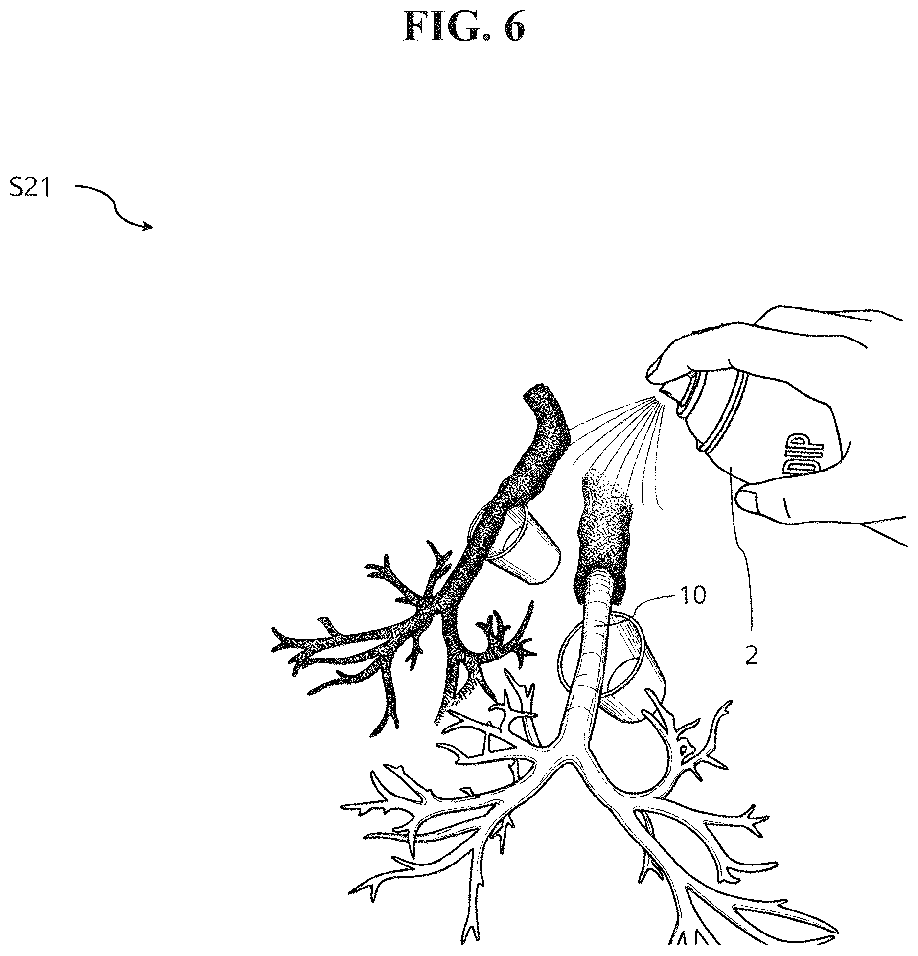 Patent US12592165 Figure 6 – Manufacturing method of bronchoscopy simulator