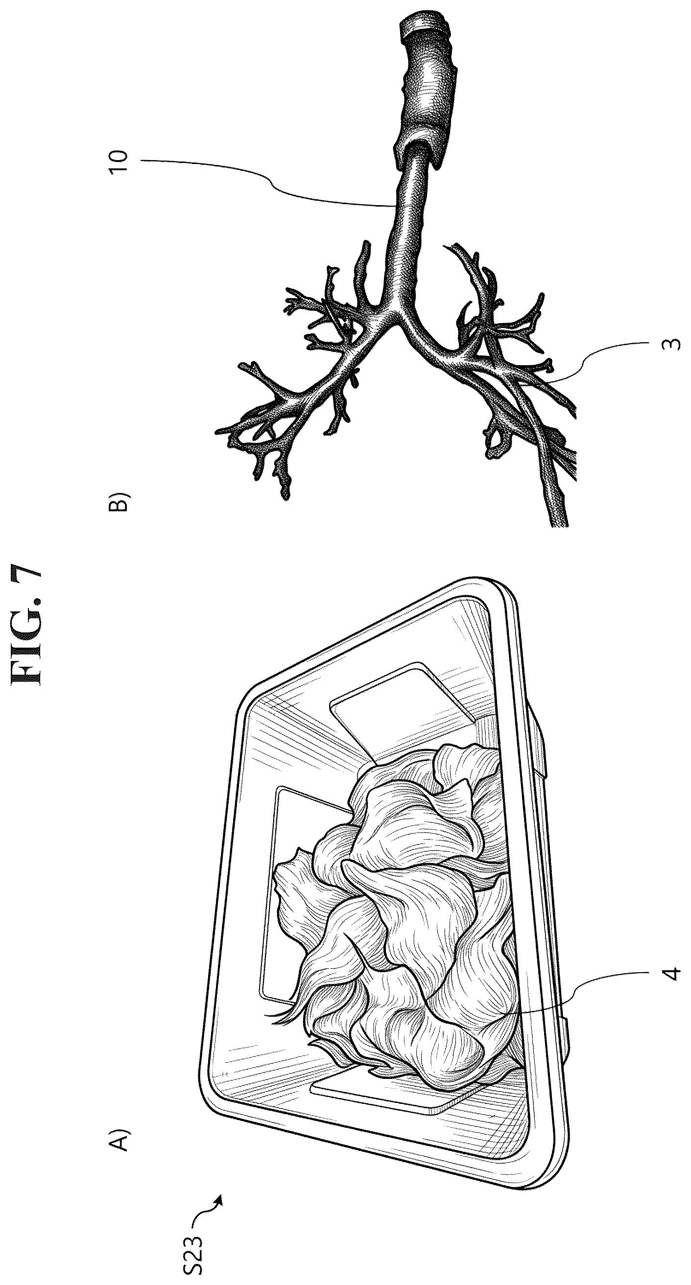 Patent US12592165 Figure 7 – Manufacturing method of bronchoscopy simulator