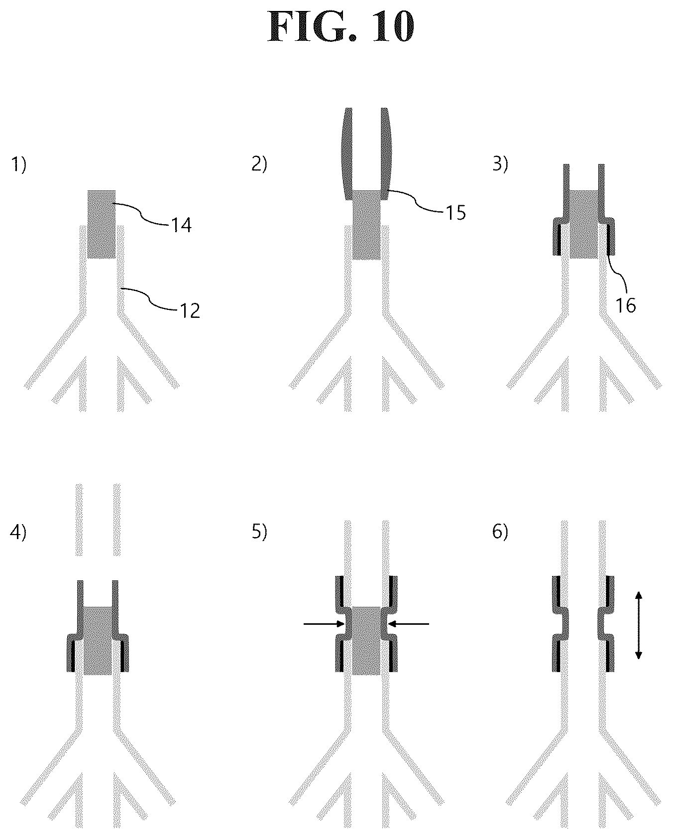 Patent US12592165 Figure 10 – Manufacturing method of bronchoscopy simulator