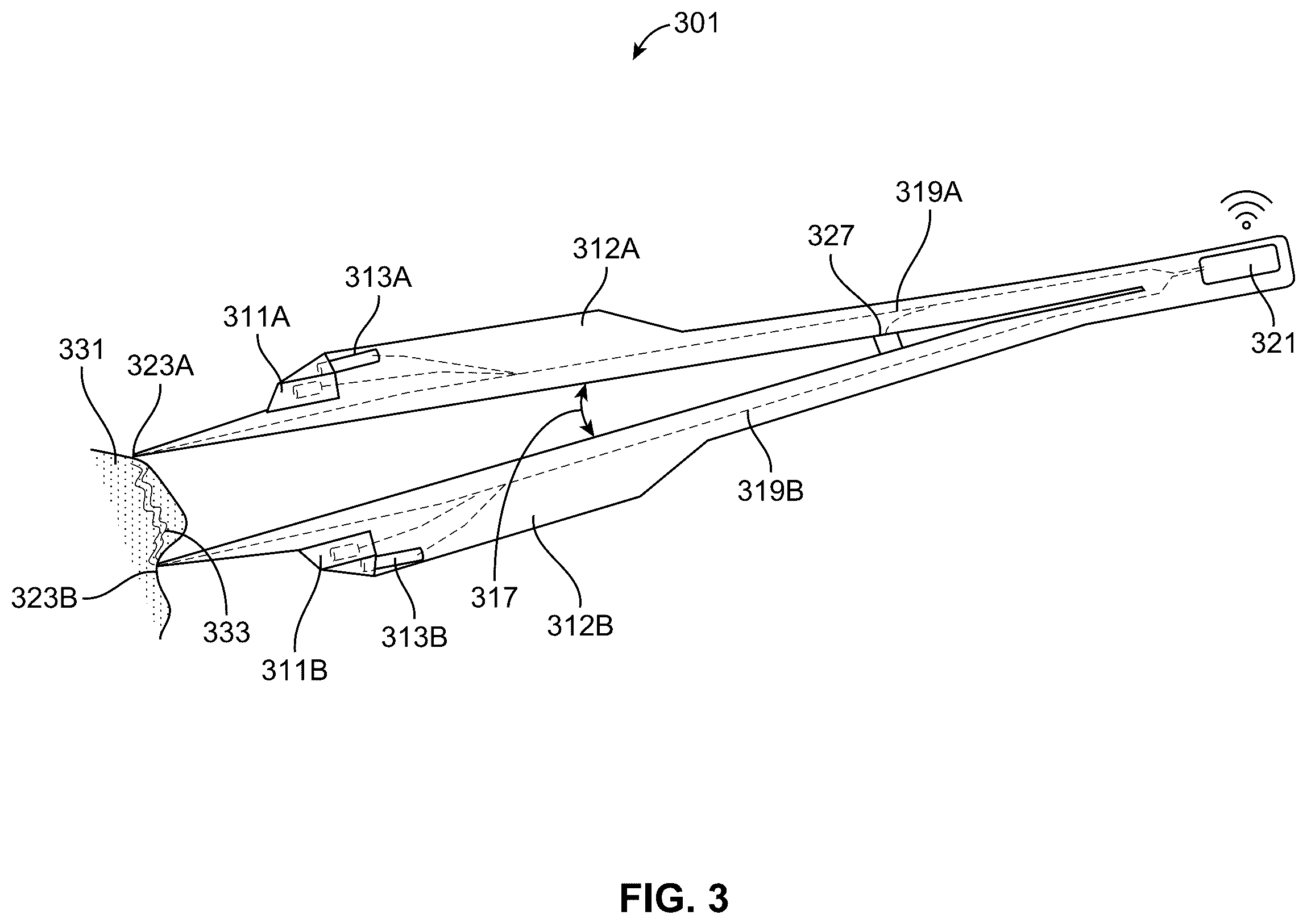 Patent US12592313 Figure 3 – Analyzing surgical videos to identify a billing coding mismatch