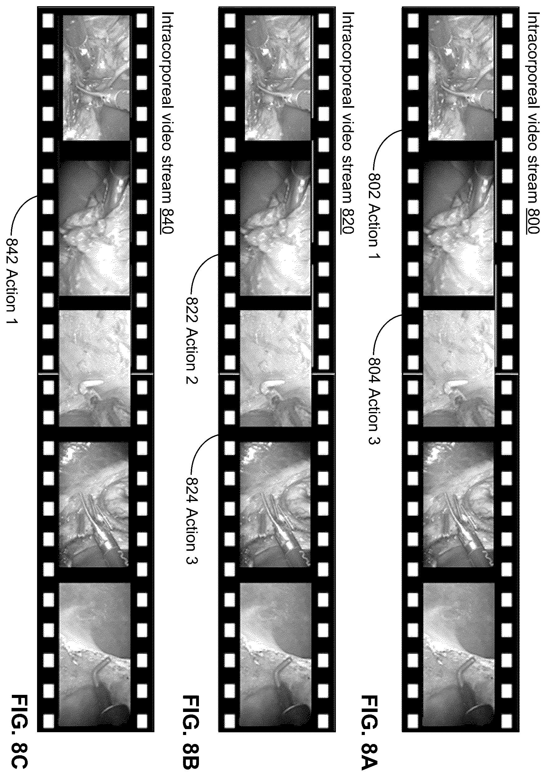 Patent US12592313 Figure 7 – Analyzing surgical videos to identify a billing coding mismatch