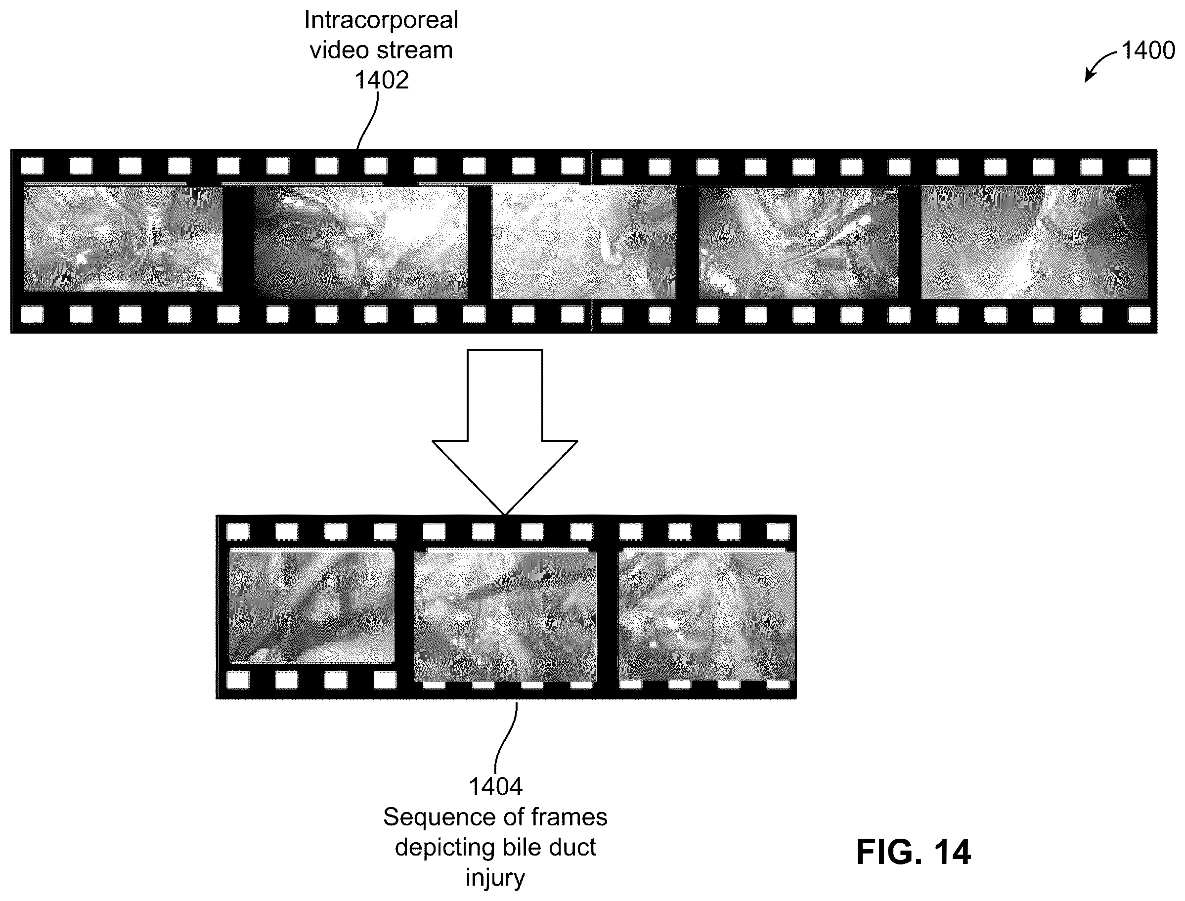 Patent US12592313 Figure 13 – Analyzing surgical videos to identify a billing coding mismatch