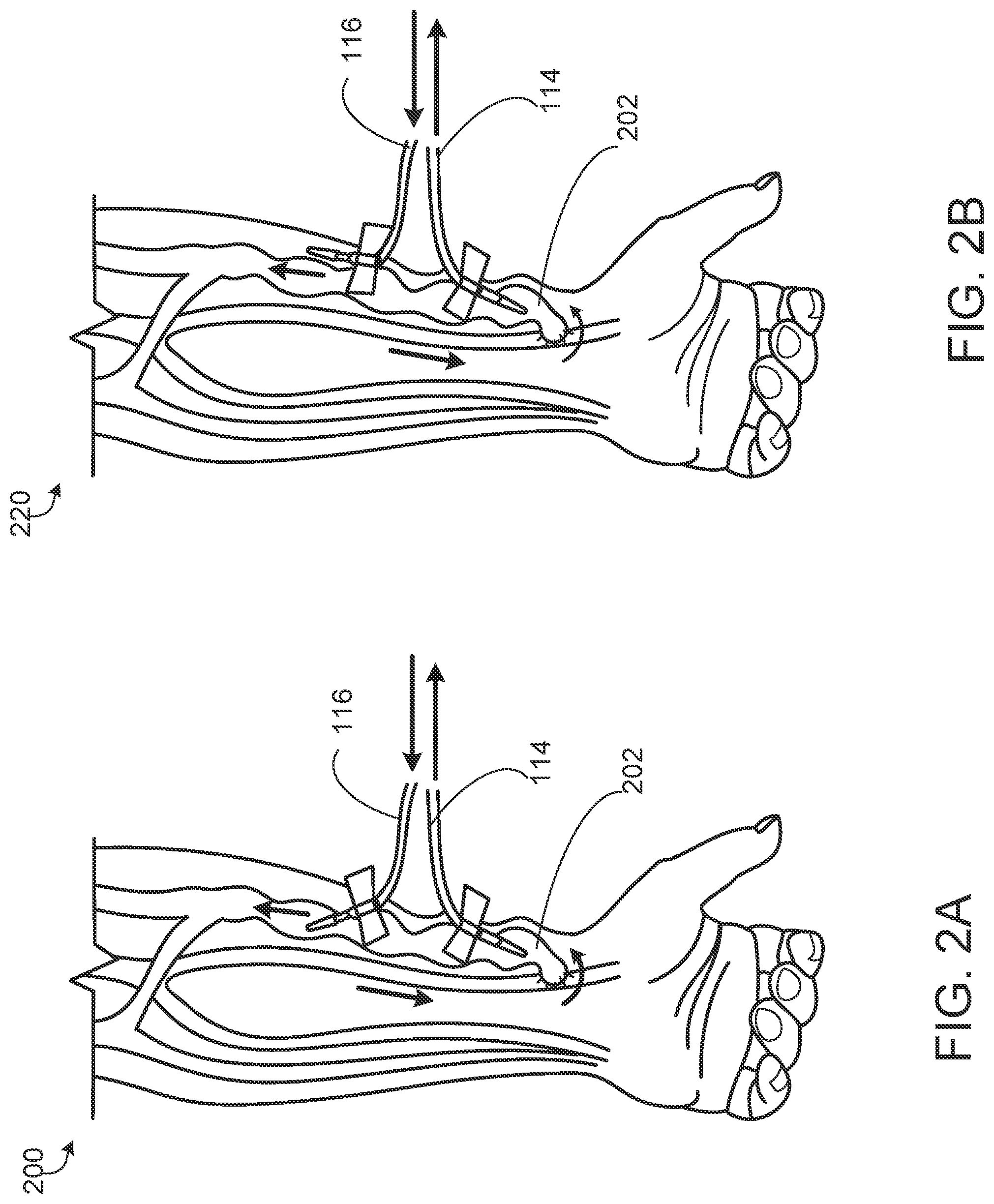Patent US12592316 Figure 2 – Diagnostic methods and systems using sound detection