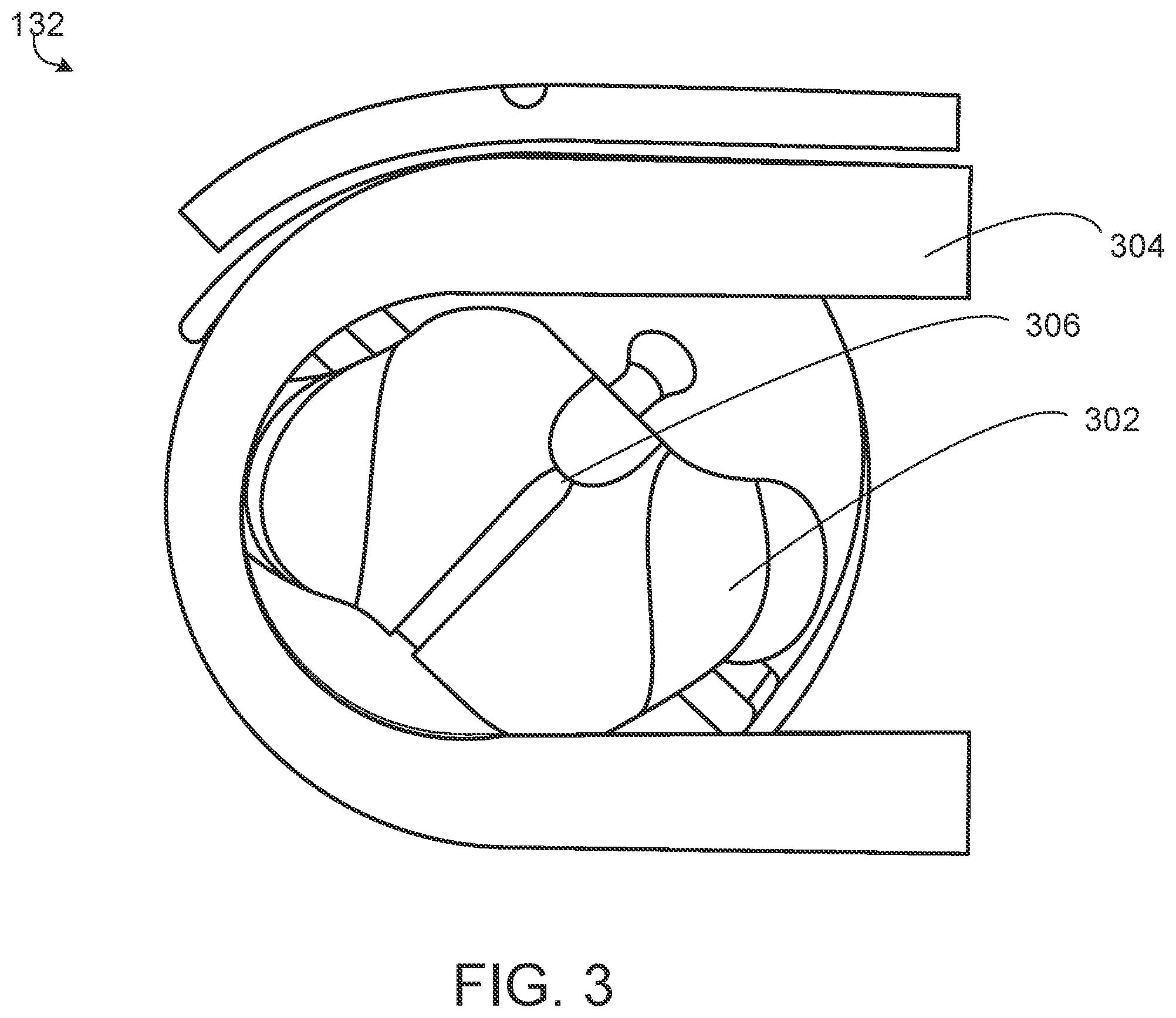 Patent US12592316 Figure 3 – Diagnostic methods and systems using sound detection