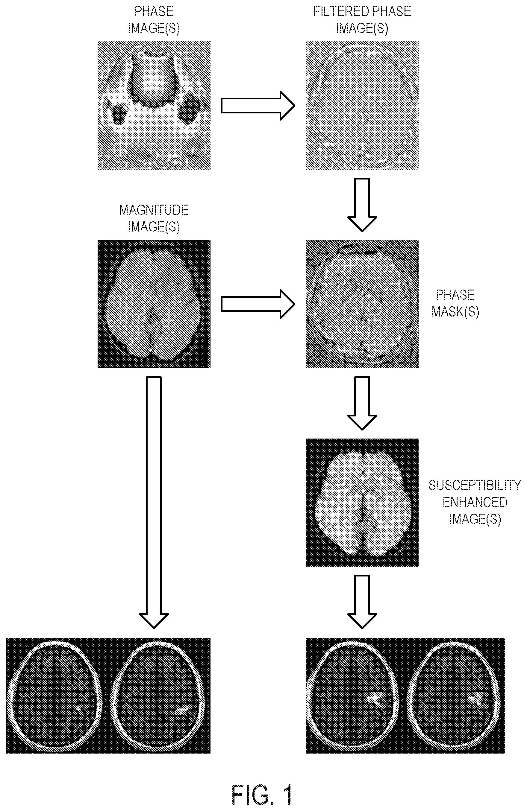 Patent US12592318 Figure 1 – Neuronal activity mapping using phase-based susceptibility-enhanced functional magnetic resonance imaging