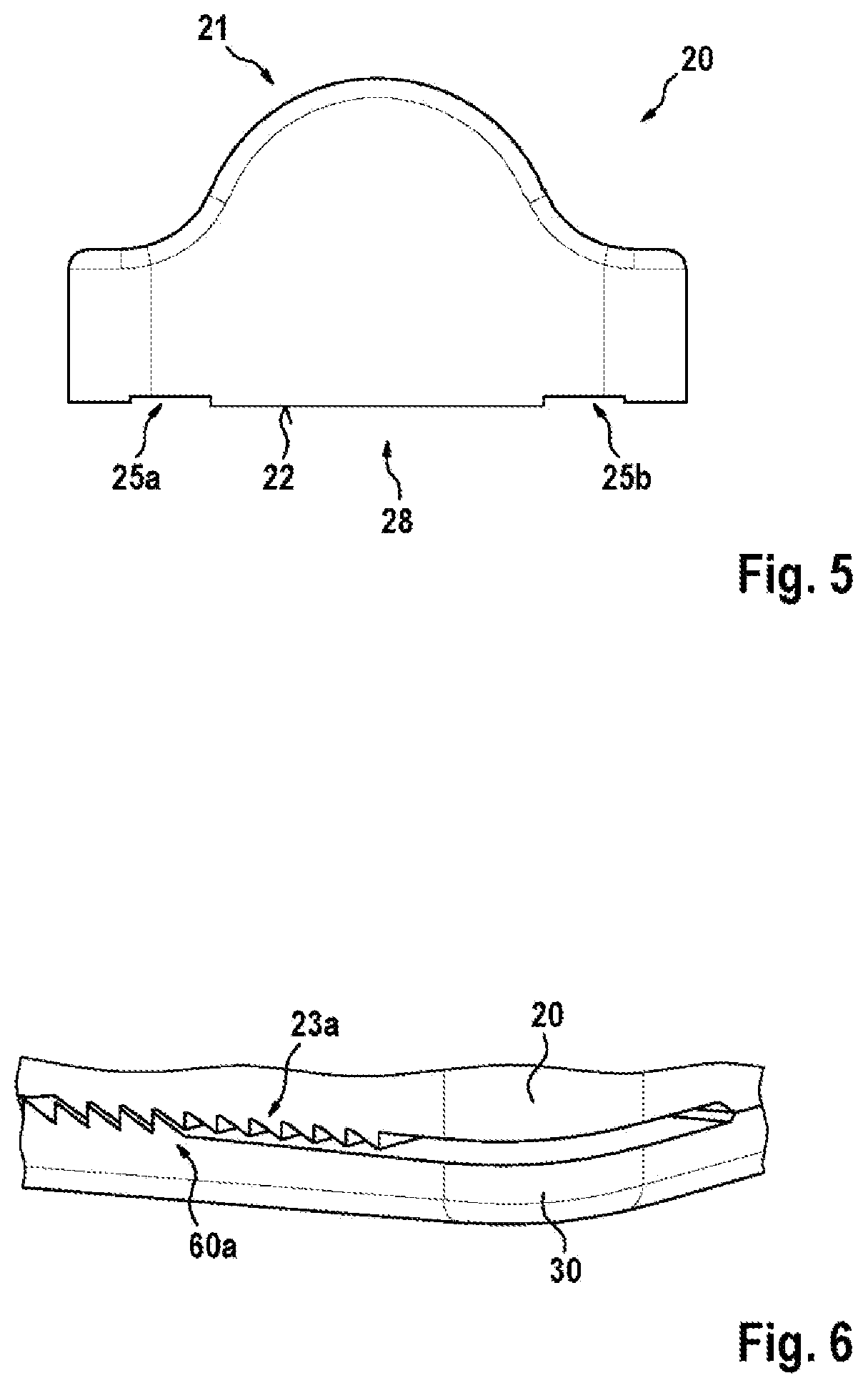 Patent US12592445 Figure 3 – Electrochemical energy storage system, vehicle, method for fixing and positioning a component, and pair of wedge bodies