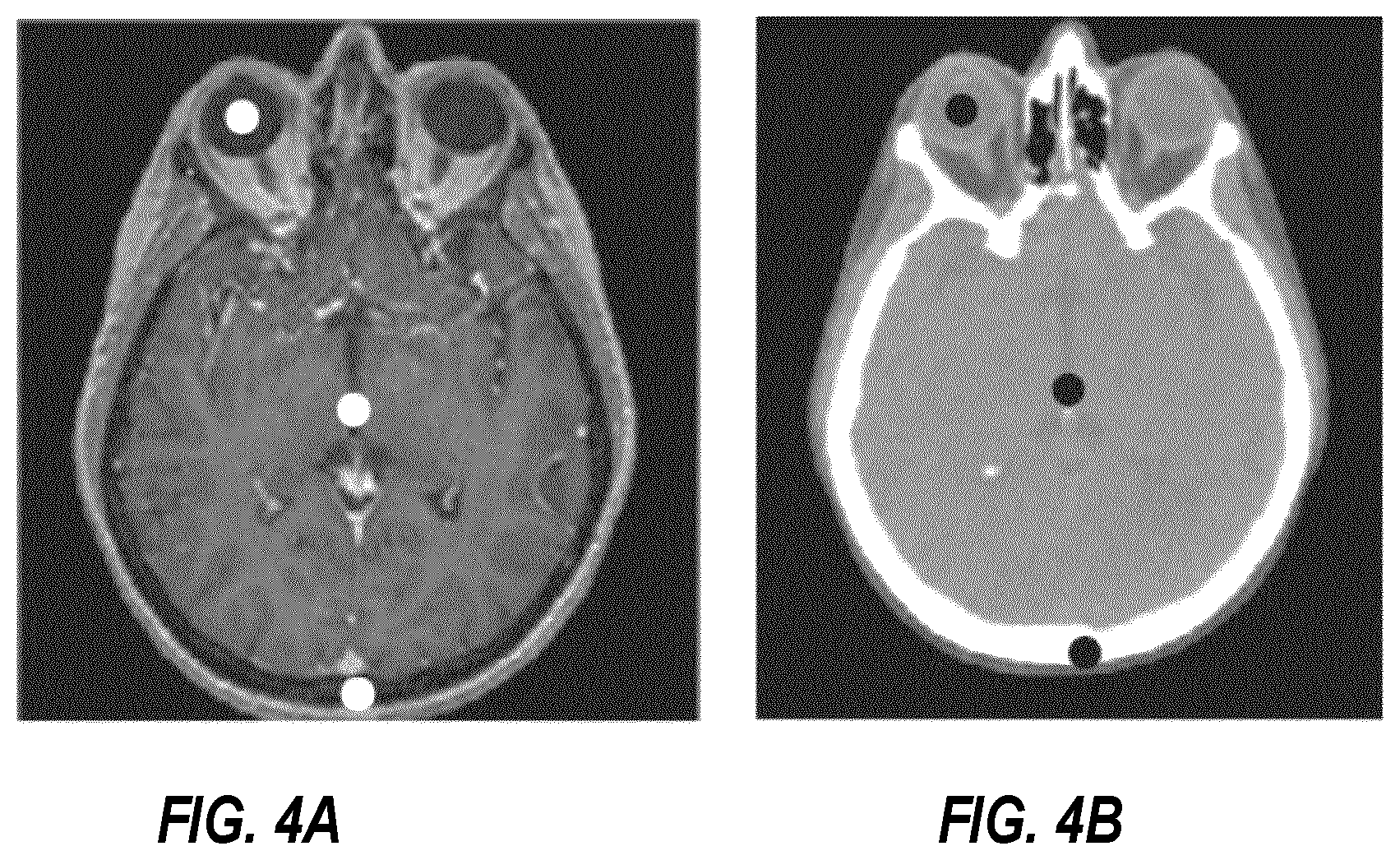Patent US12597088 Figure 5 – Quality factor using reconstructed images
