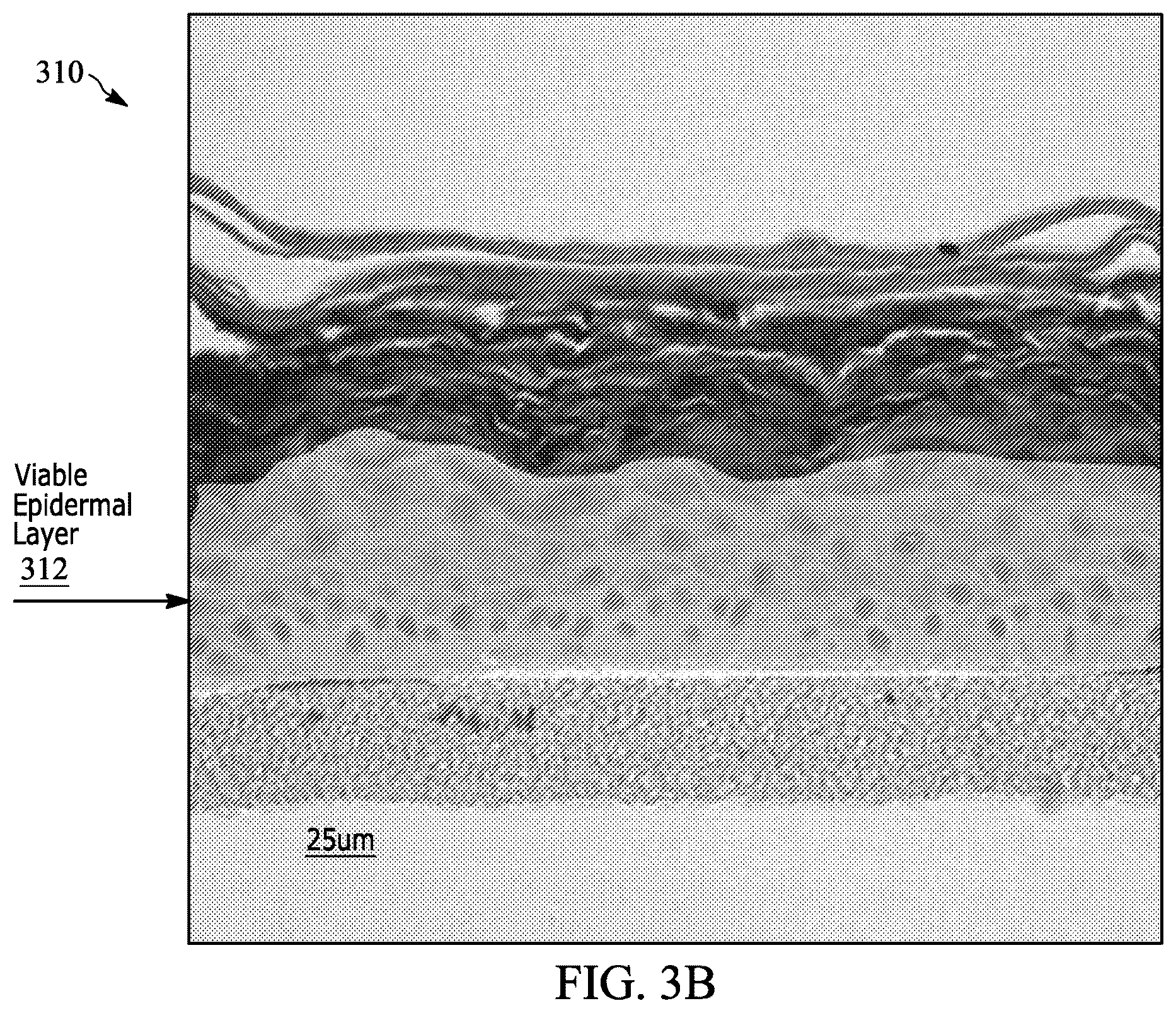 Patent US12597128 Figure 4 – Assessment of skin toxicity in an in vitro tissue samples using deep learning