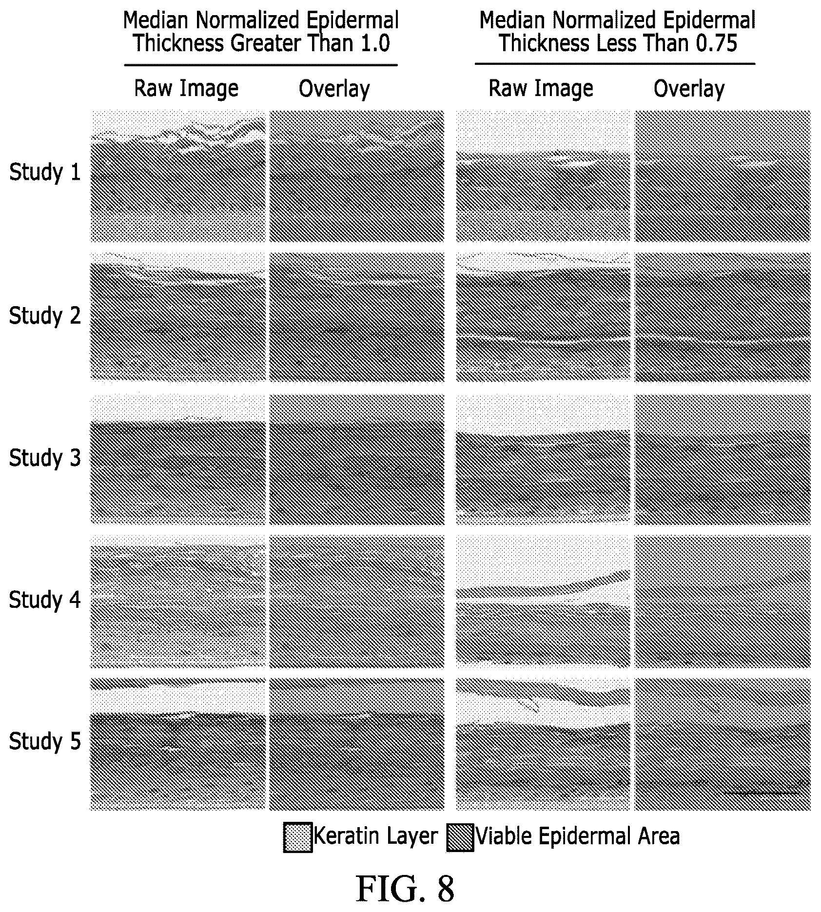Patent US12597128 Figure 13 – Assessment of skin toxicity in an in vitro tissue samples using deep learning