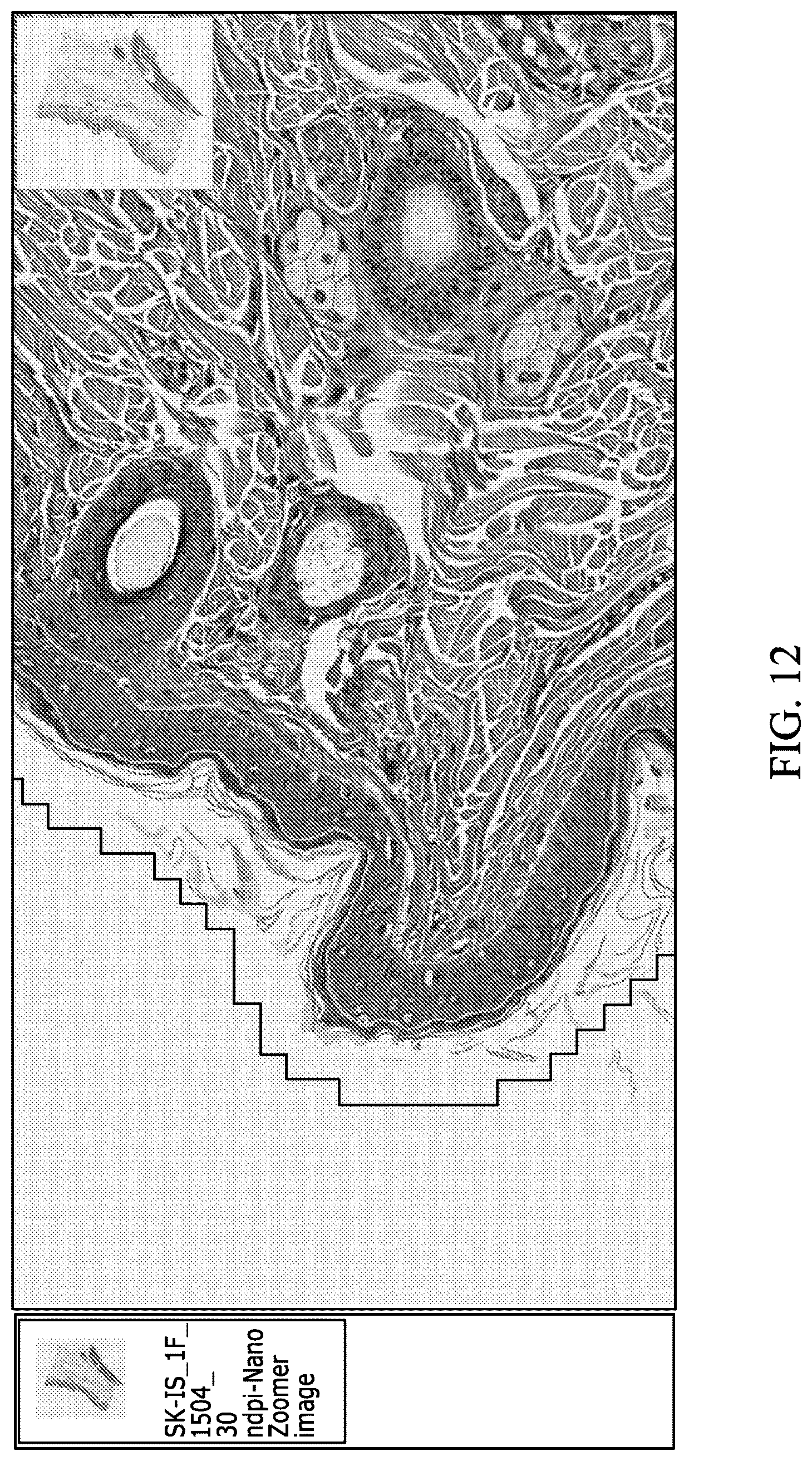 Patent US12597128 Figure 18 – Assessment of skin toxicity in an in vitro tissue samples using deep learning
