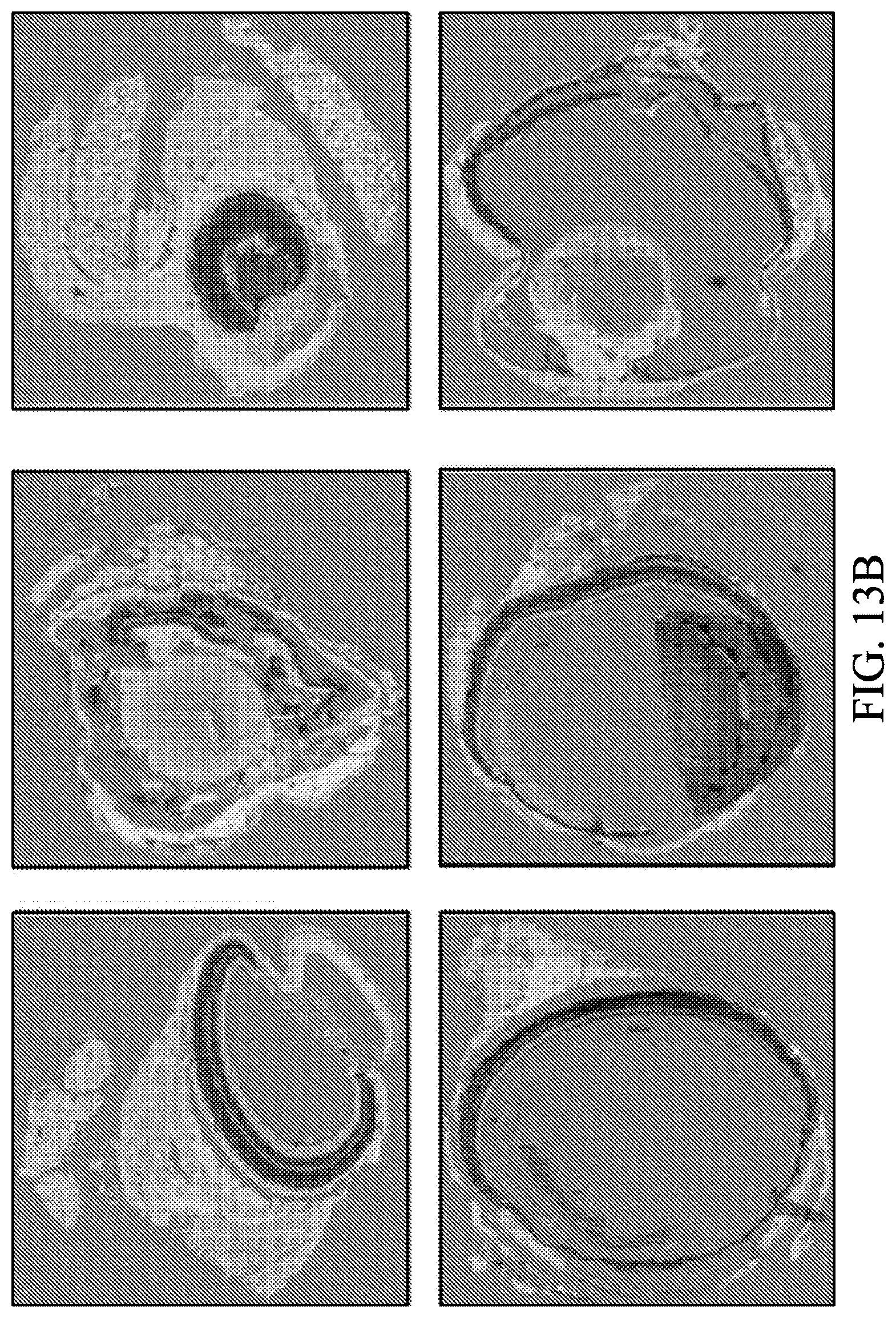 Patent US12597128 Figure 20 – Assessment of skin toxicity in an in vitro tissue samples using deep learning