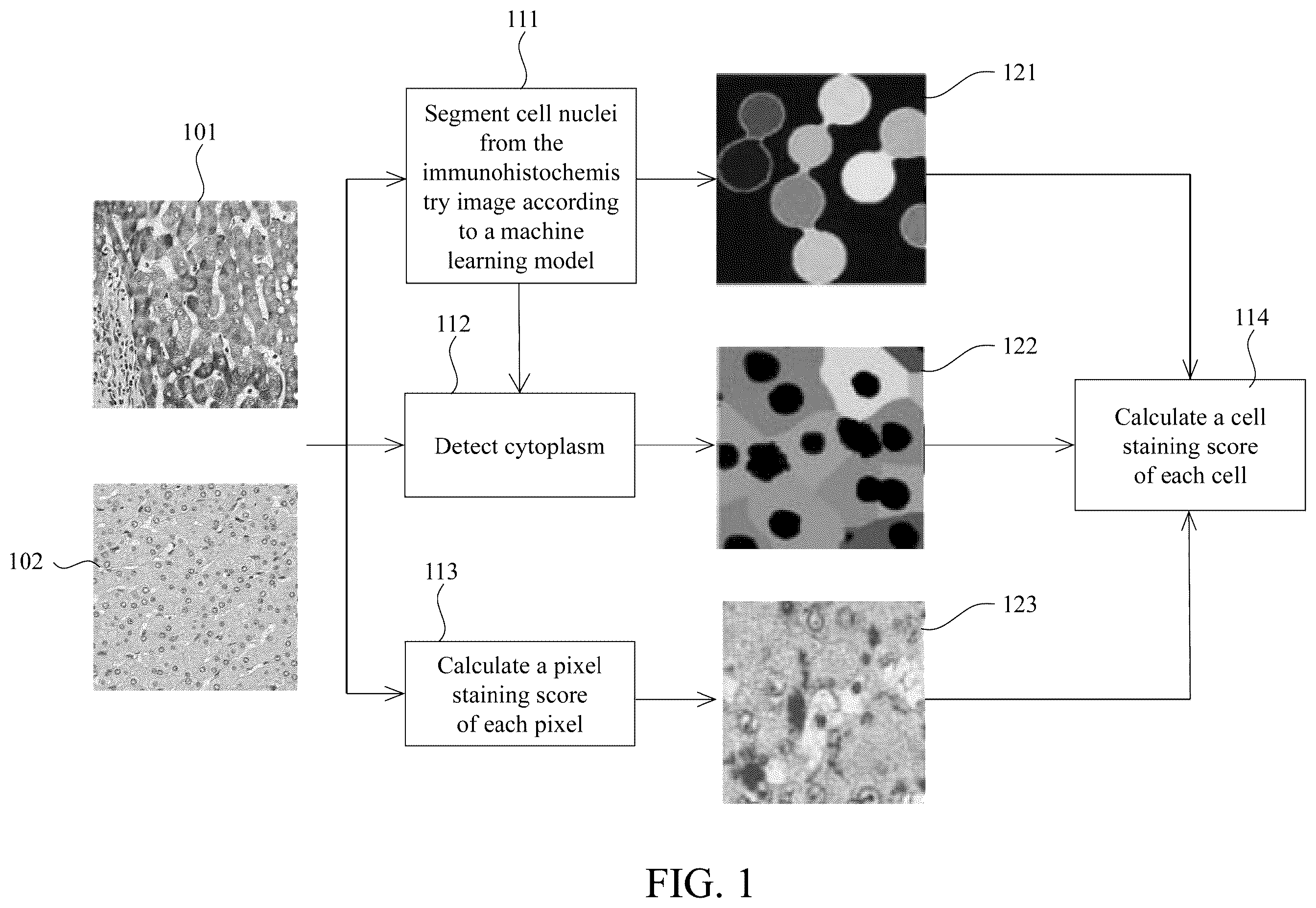 Patent US12597129 Figure 1 – Method for analyzing immunohistochemistry images