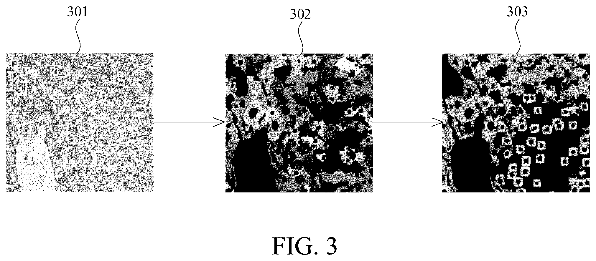 Patent US12597129 Figure 3 – Method for analyzing immunohistochemistry images
