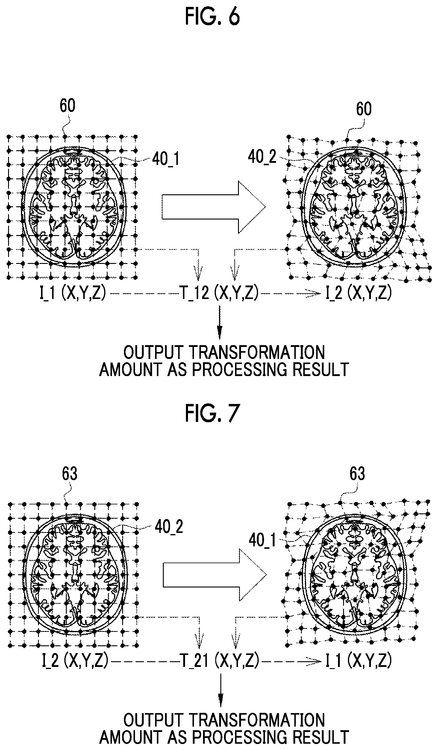 Patent US12597130 Figure 5 – Image processing apparatus, operation method of image processing apparatus, and operation program of image processing apparatus for generating examination results of new medical examinations
