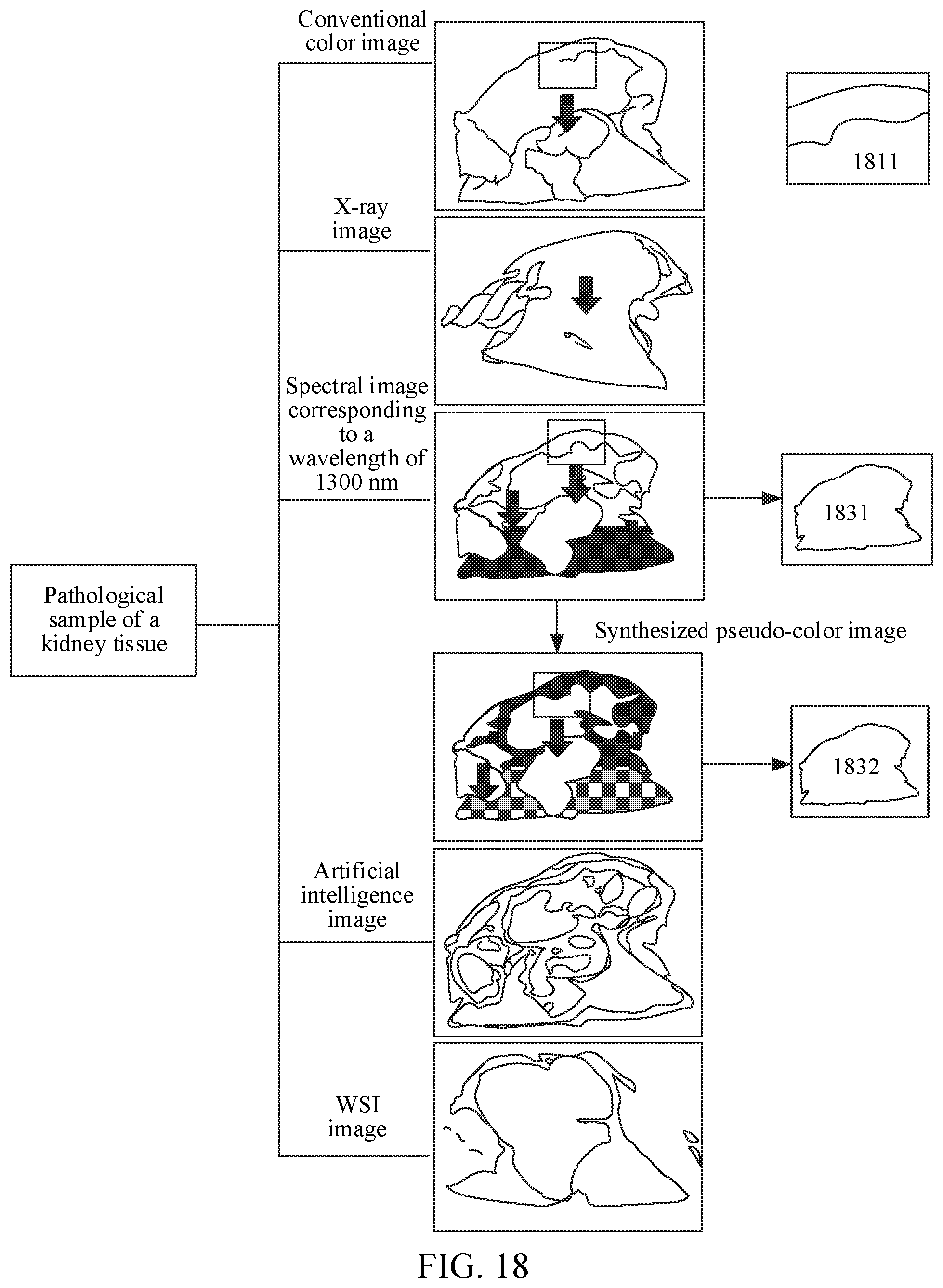 Patent US12597132 Figure 13 – Image processing method and apparatus