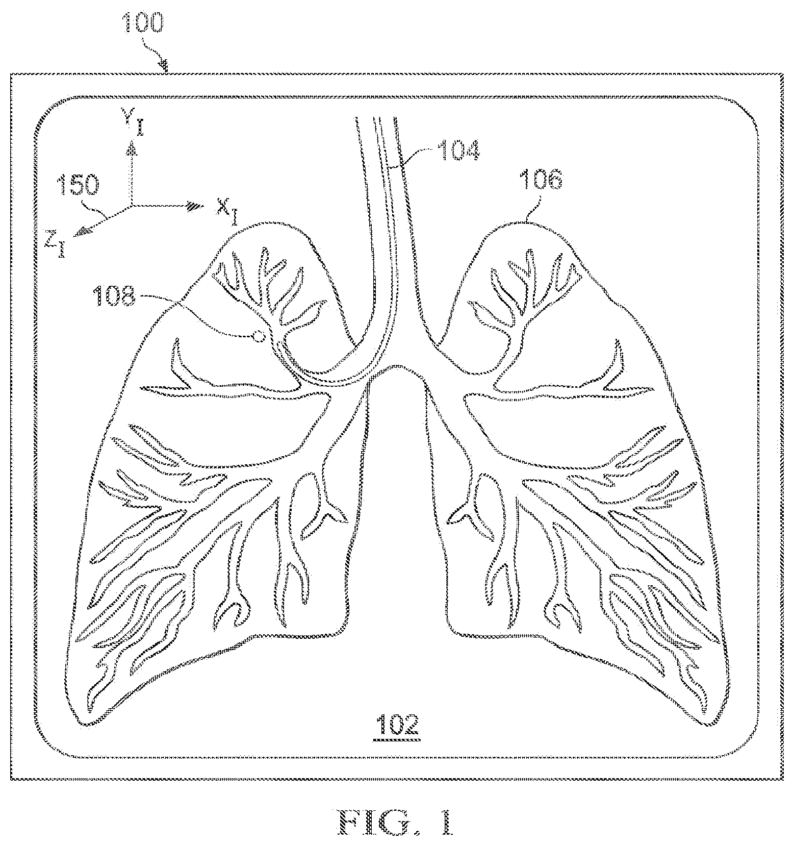 Patent US12597135 Figure 1 – Systems and methods for updating a graphical user interface based upon intraoperative imaging
